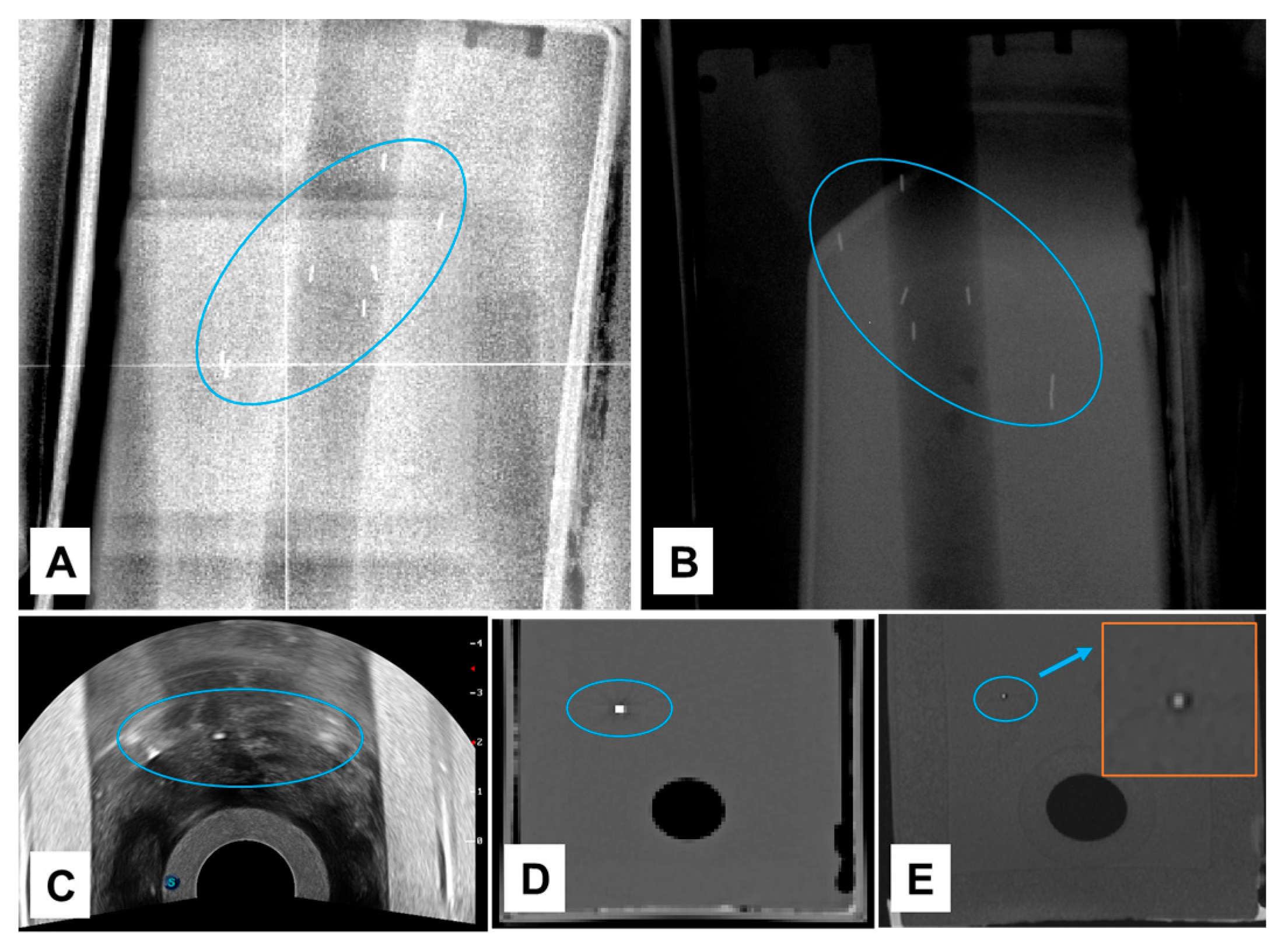 Cancers 16 00625 g0a3