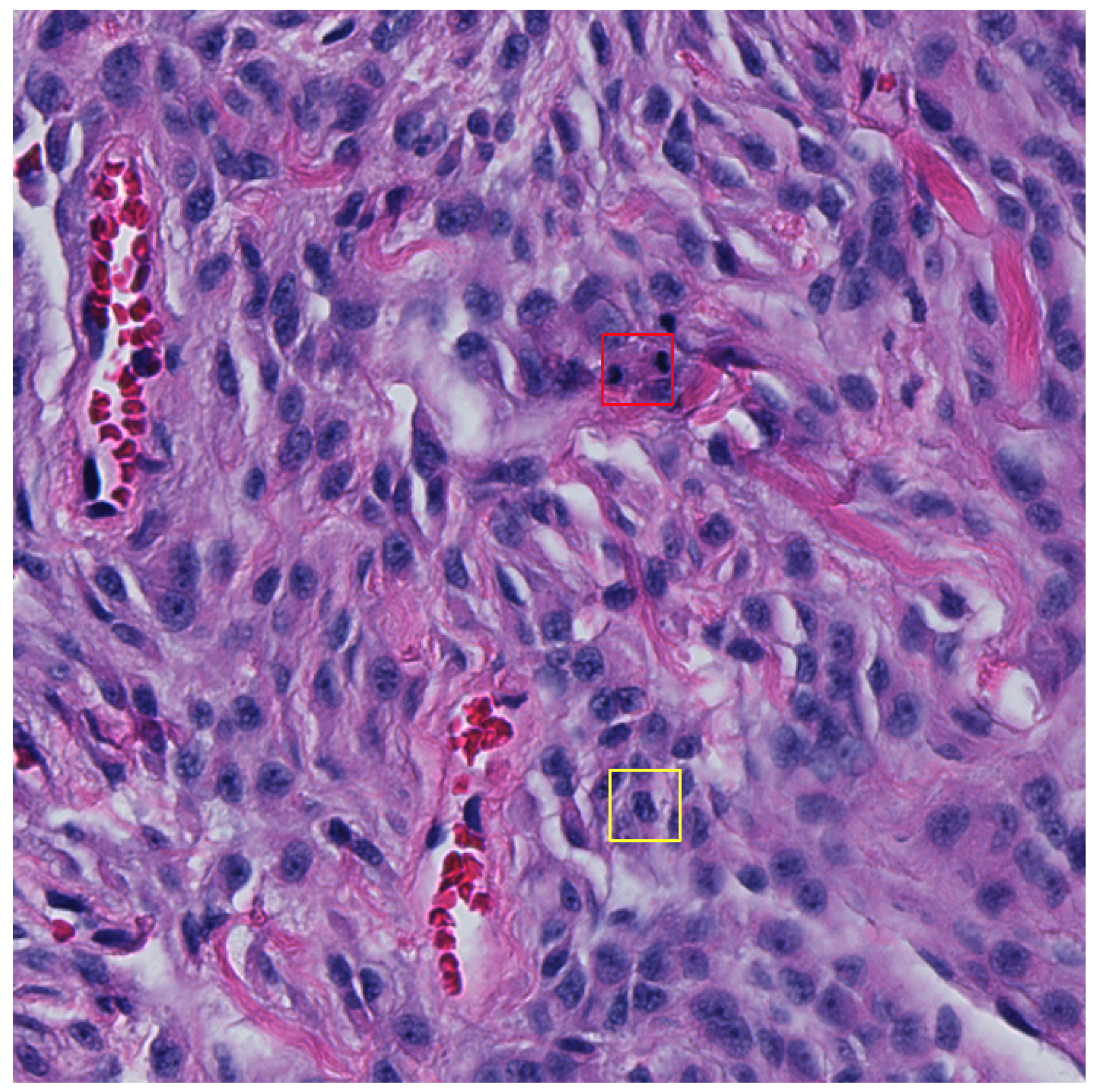 Cancers 16 00644 g005