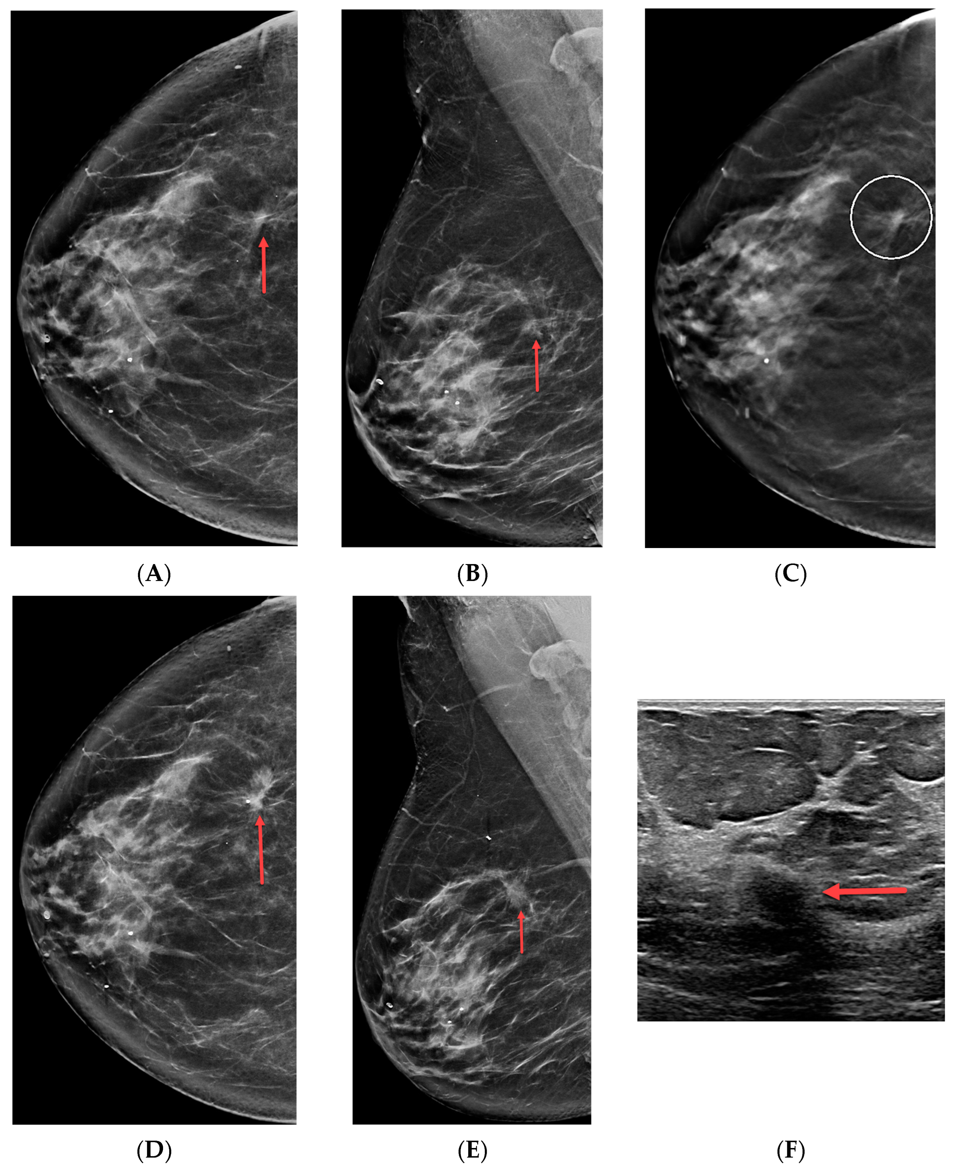 Cancers 16 00655 g002