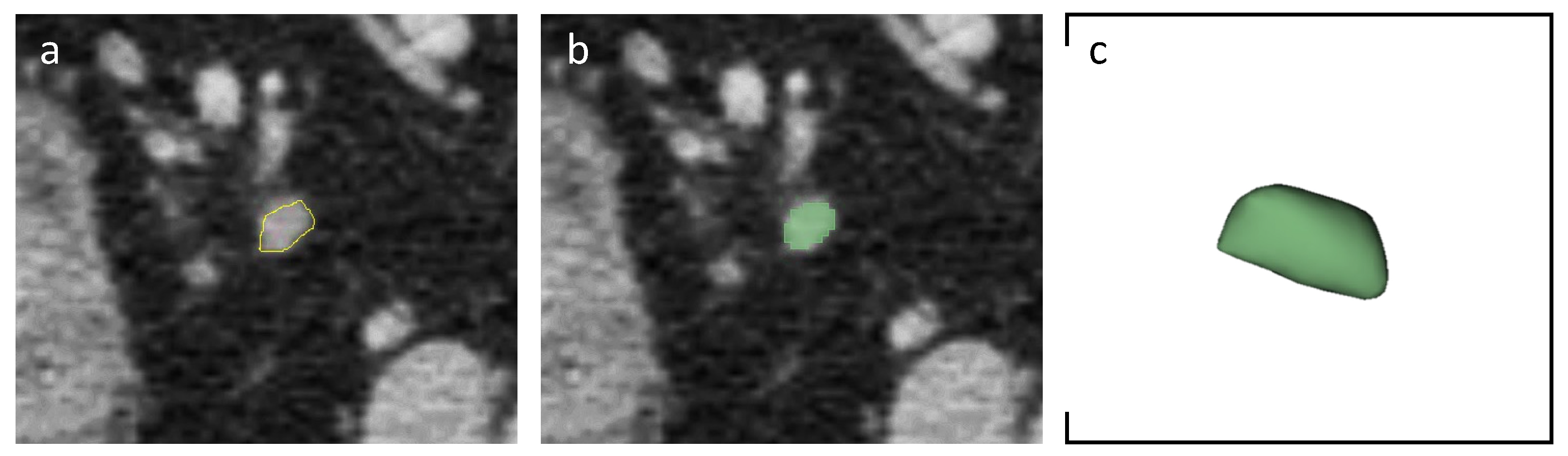 Cancers 16 00660 g001