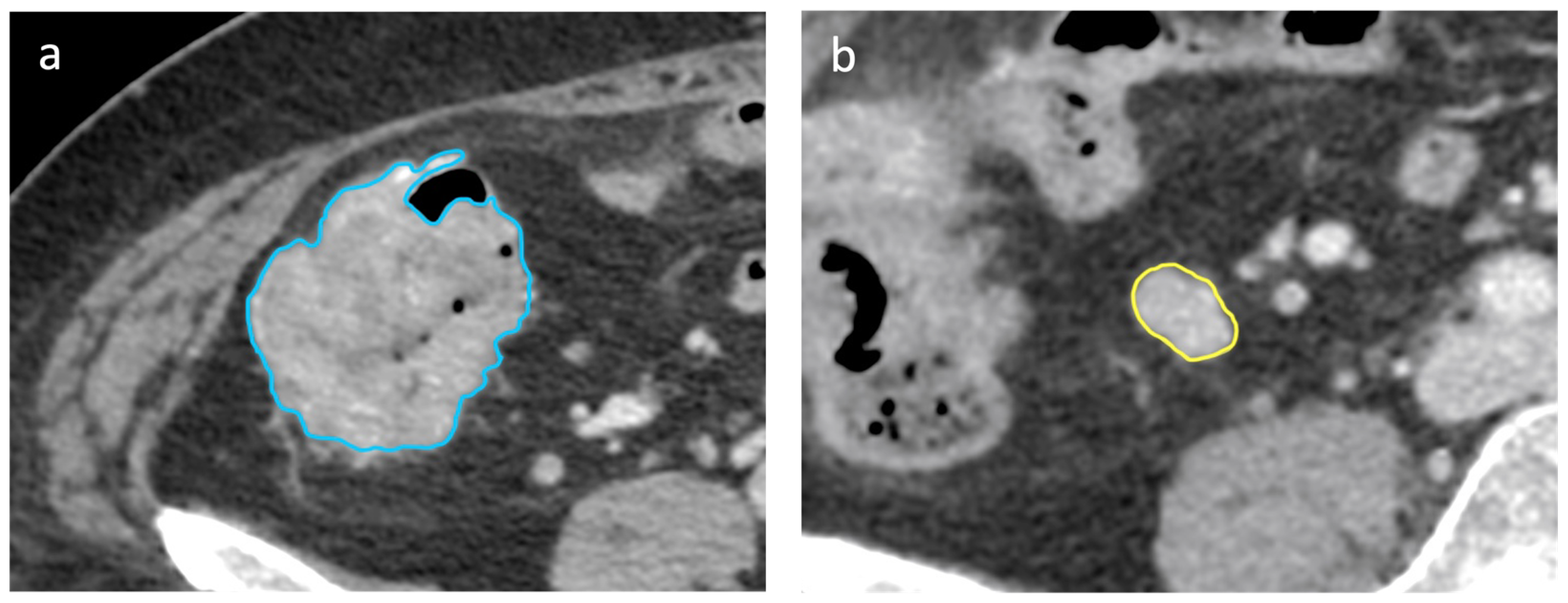 Cancers 16 00660 g004