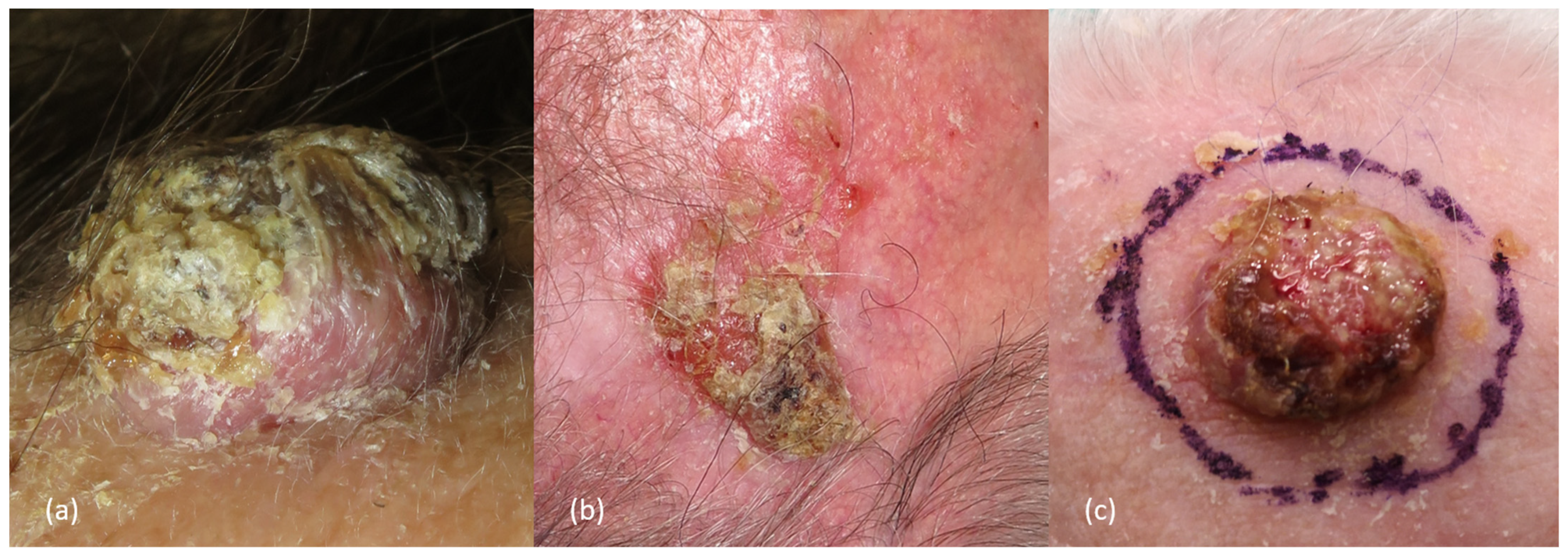 Cancers 16 00664 g002