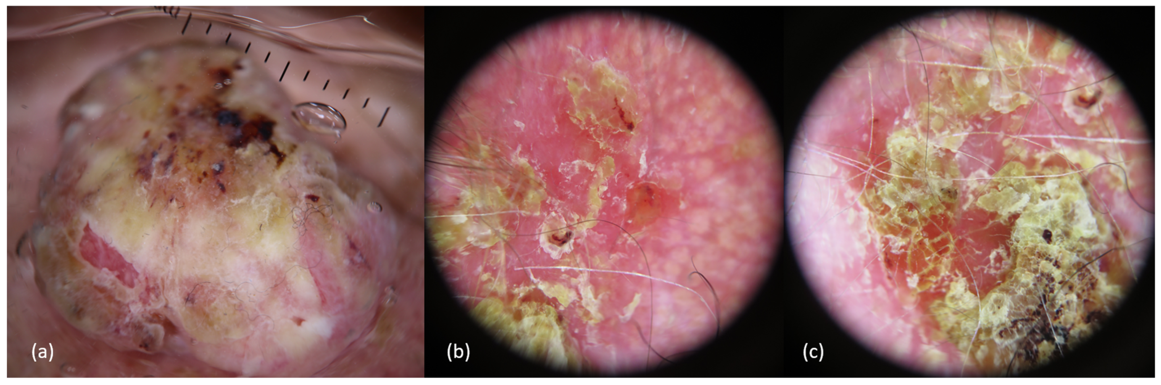 Cancers 16 00664 g003