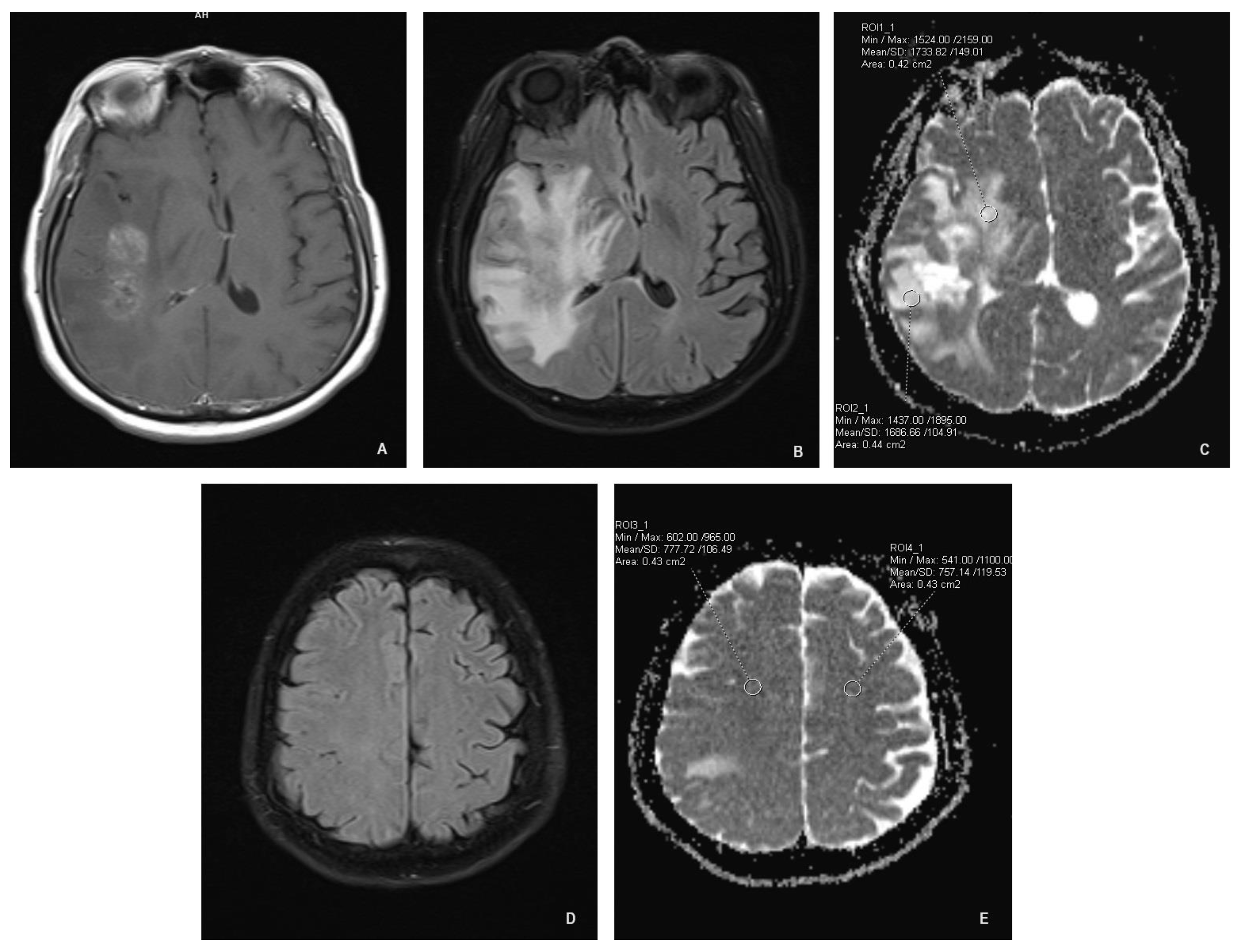 Cancers 16 00681 g001