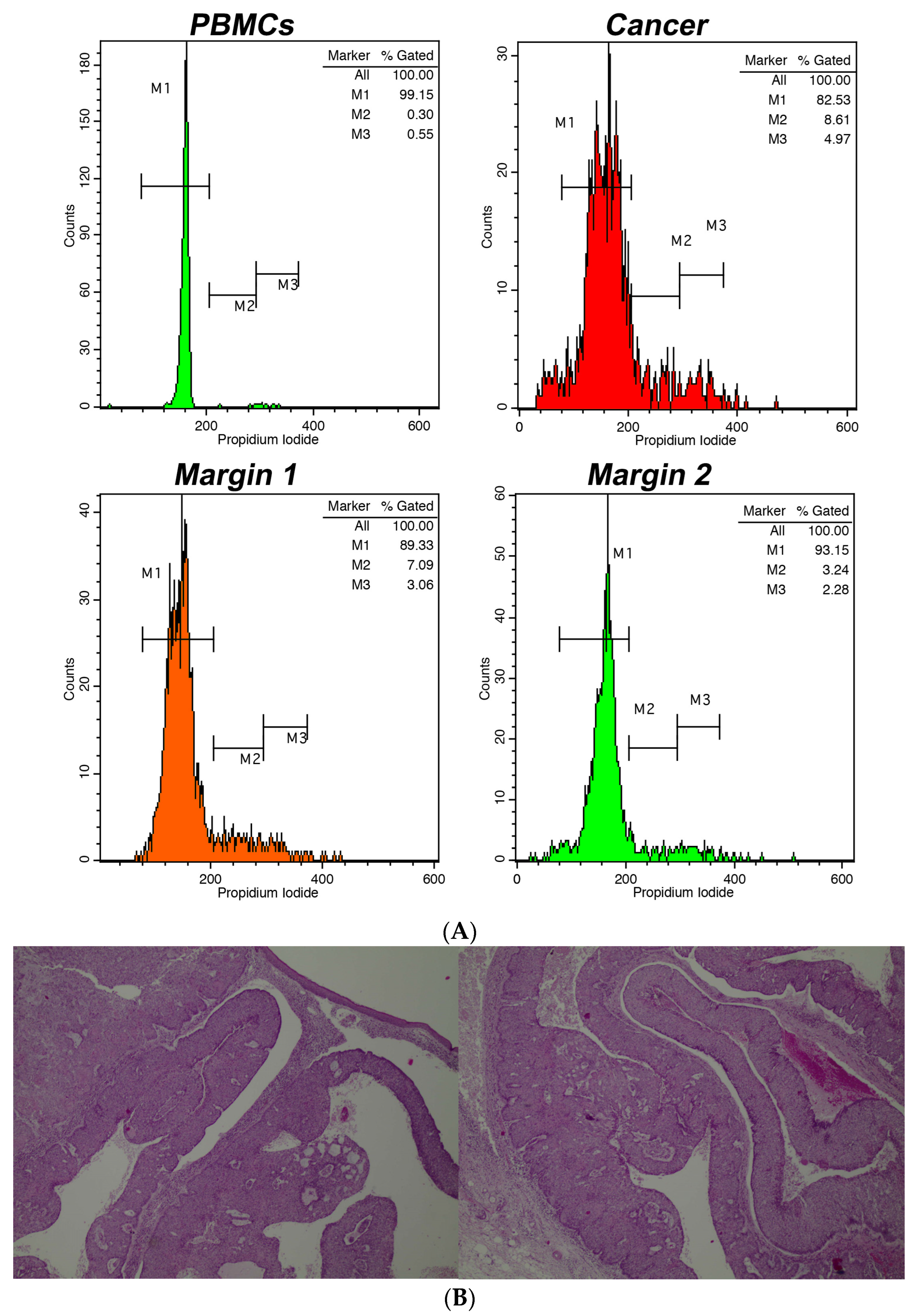 Cancers 16 00682 g001