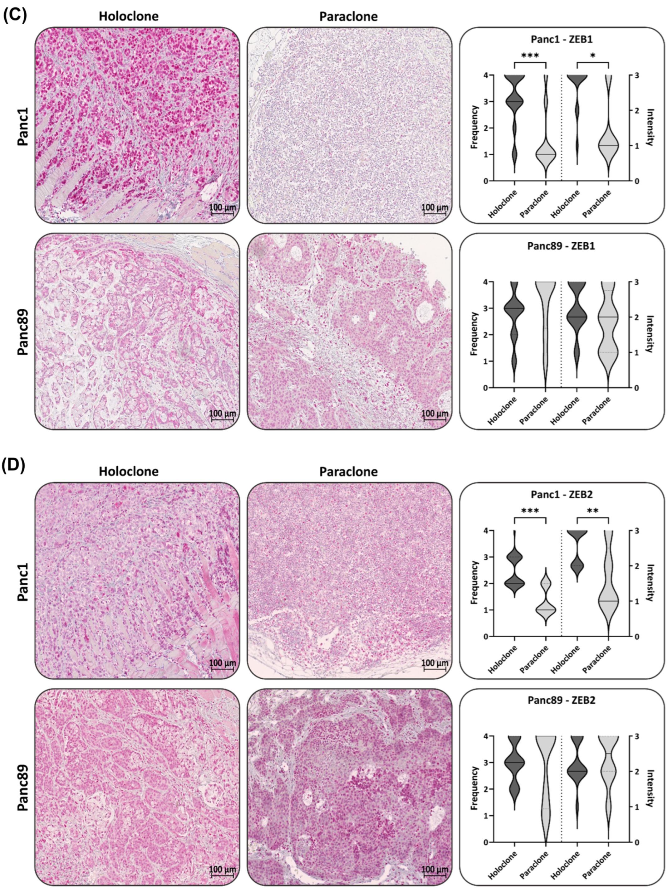 Cancers 16 00686 g006b Cancers 16 00686 g006b