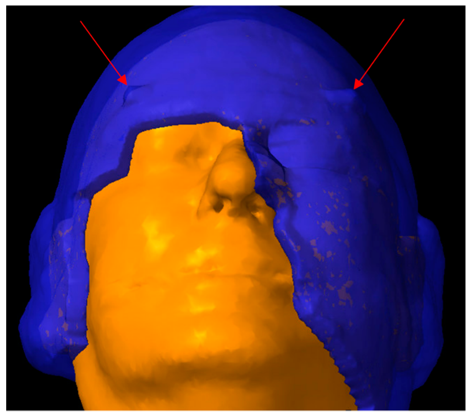 Cancers 16 00688 g001 Cancers 16 00688 g001