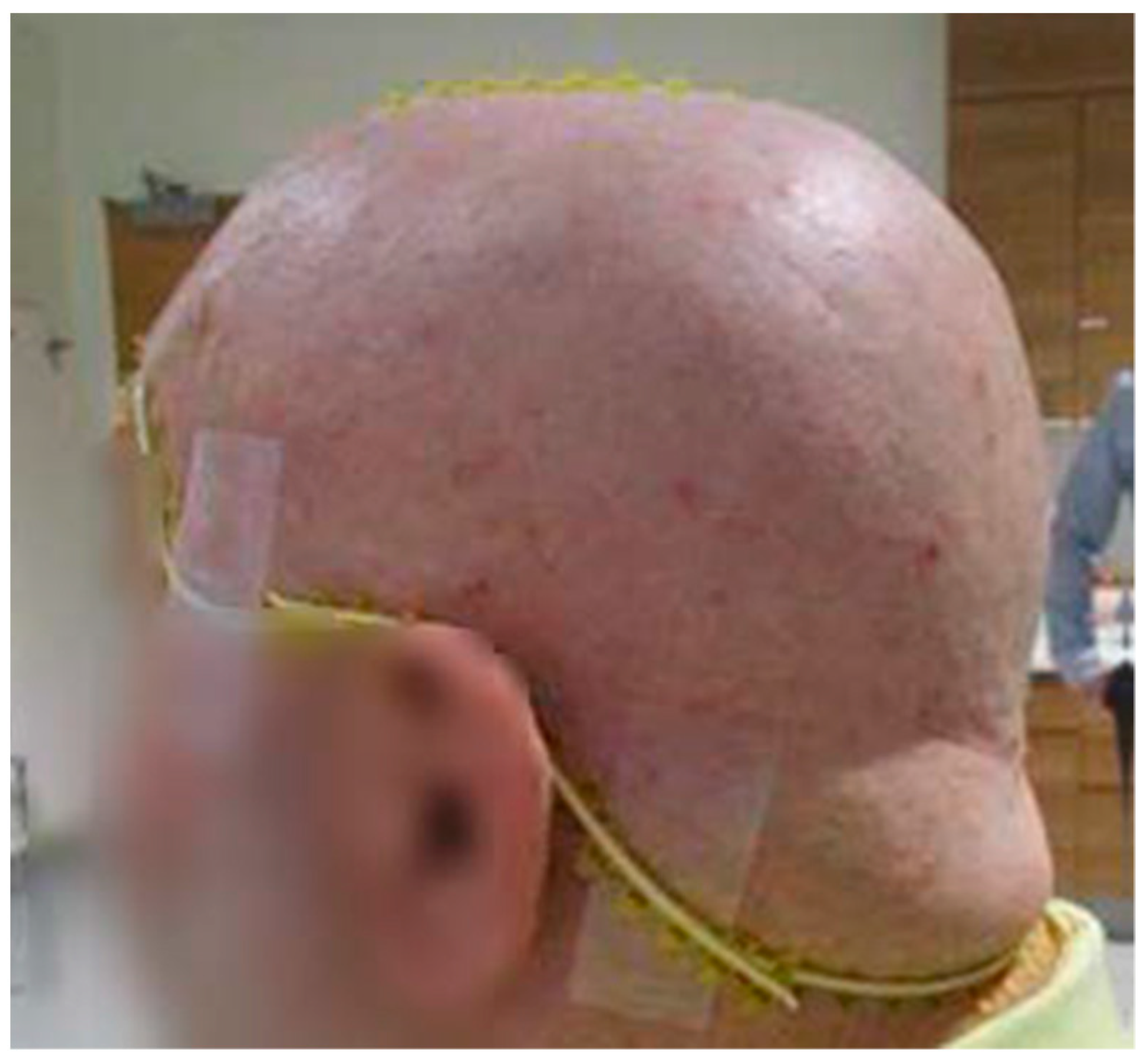 Cancers 16 00688 g002 Cancers 16 00688 g002