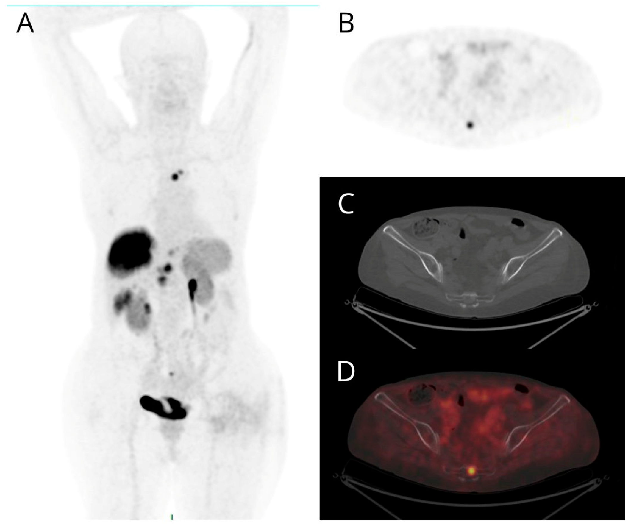 Cancers 16 00701 g001