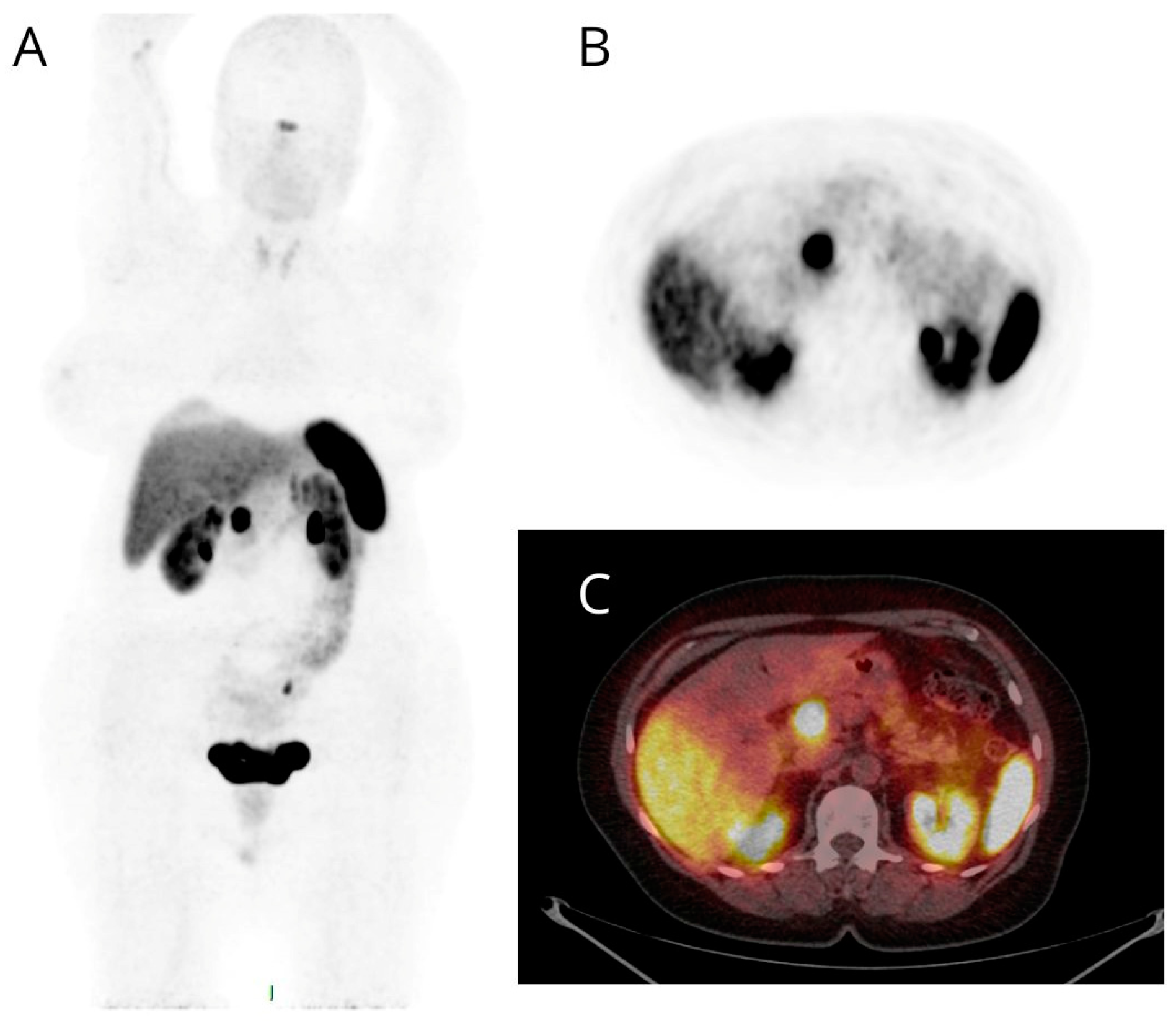 Cancers 16 00701 g002
