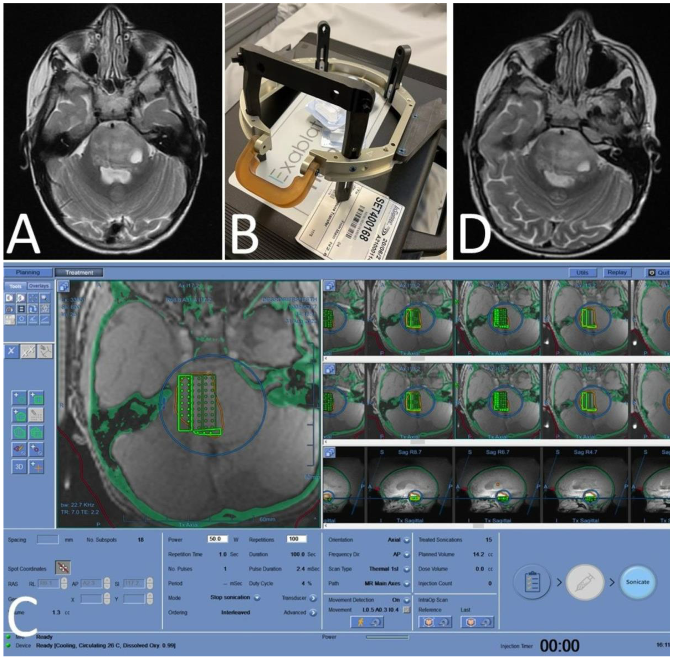 Cancers 16 00740 g009