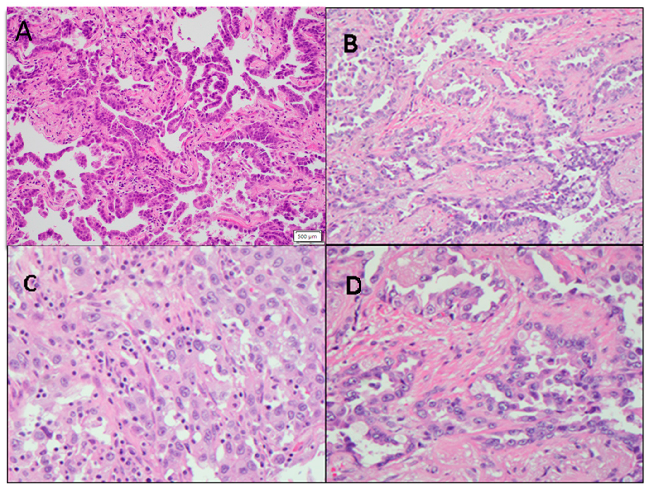 Cancers 16 00744 g004