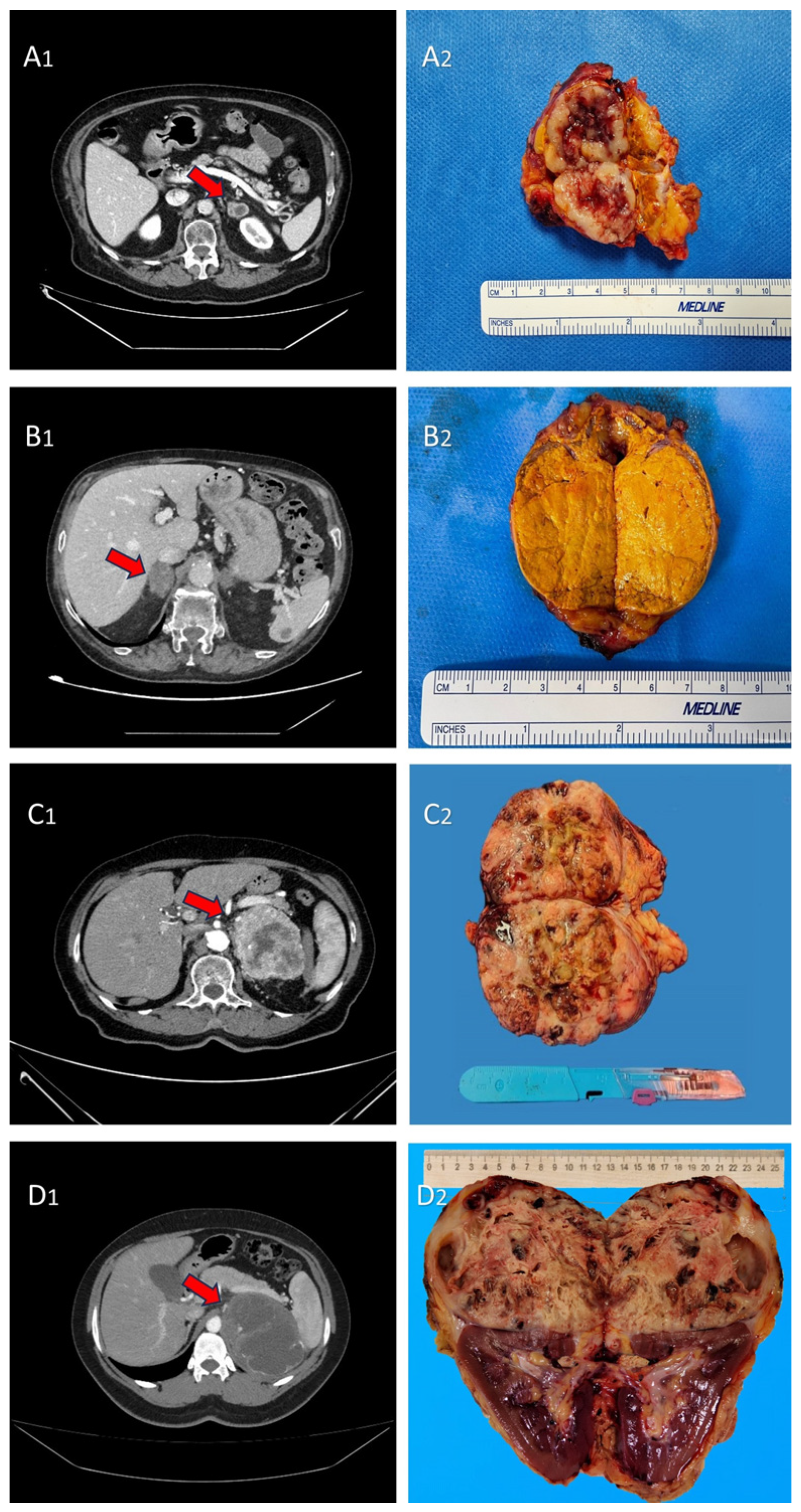 Cancers 16 00763 g001