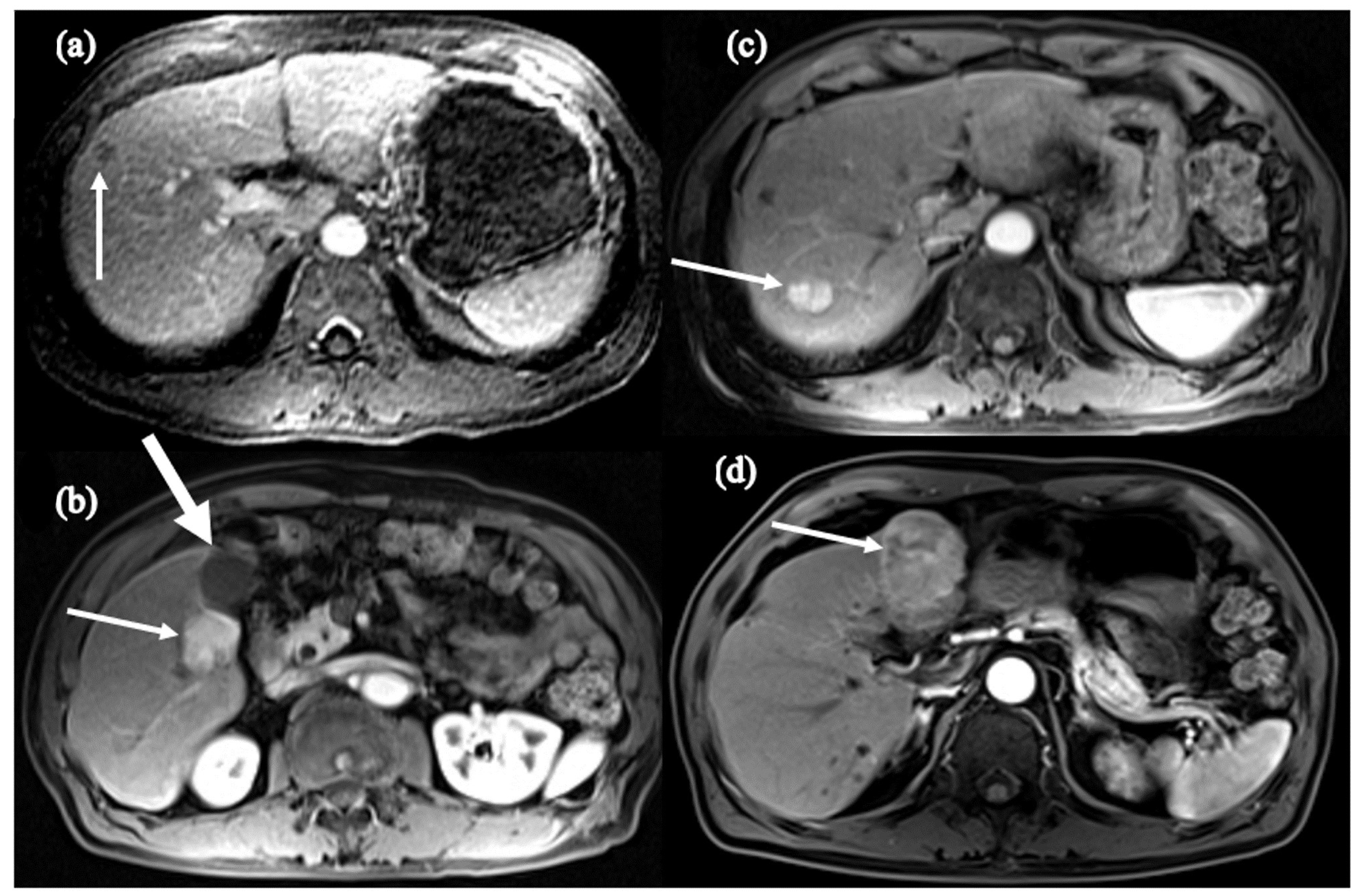 Cancers 16 00777 g005 Cancers 16 00777 g005