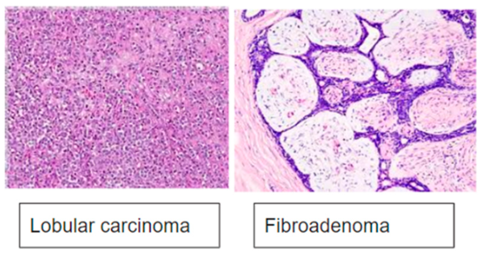 Cancers 16 00793 g001b