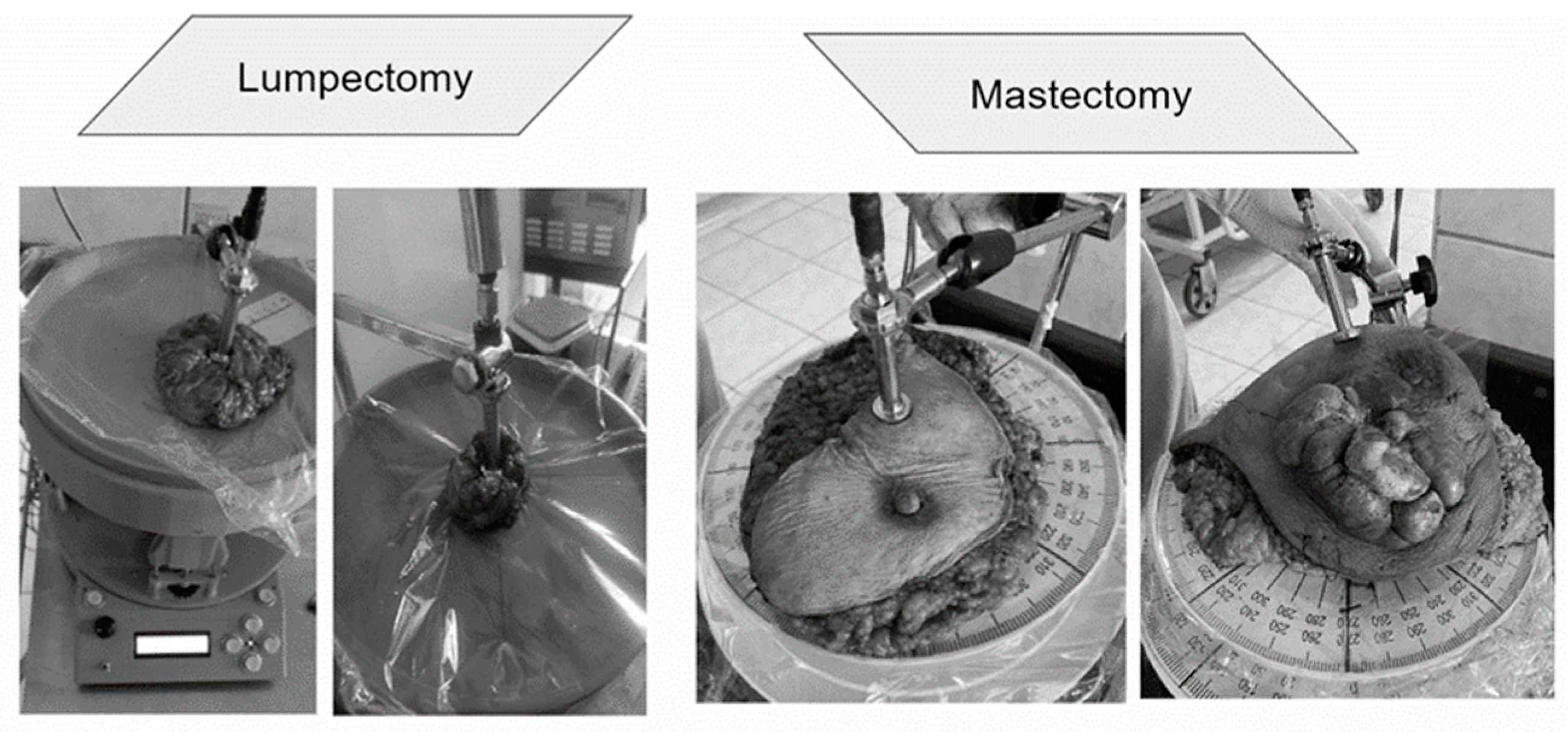 Cancers 16 00793 g006