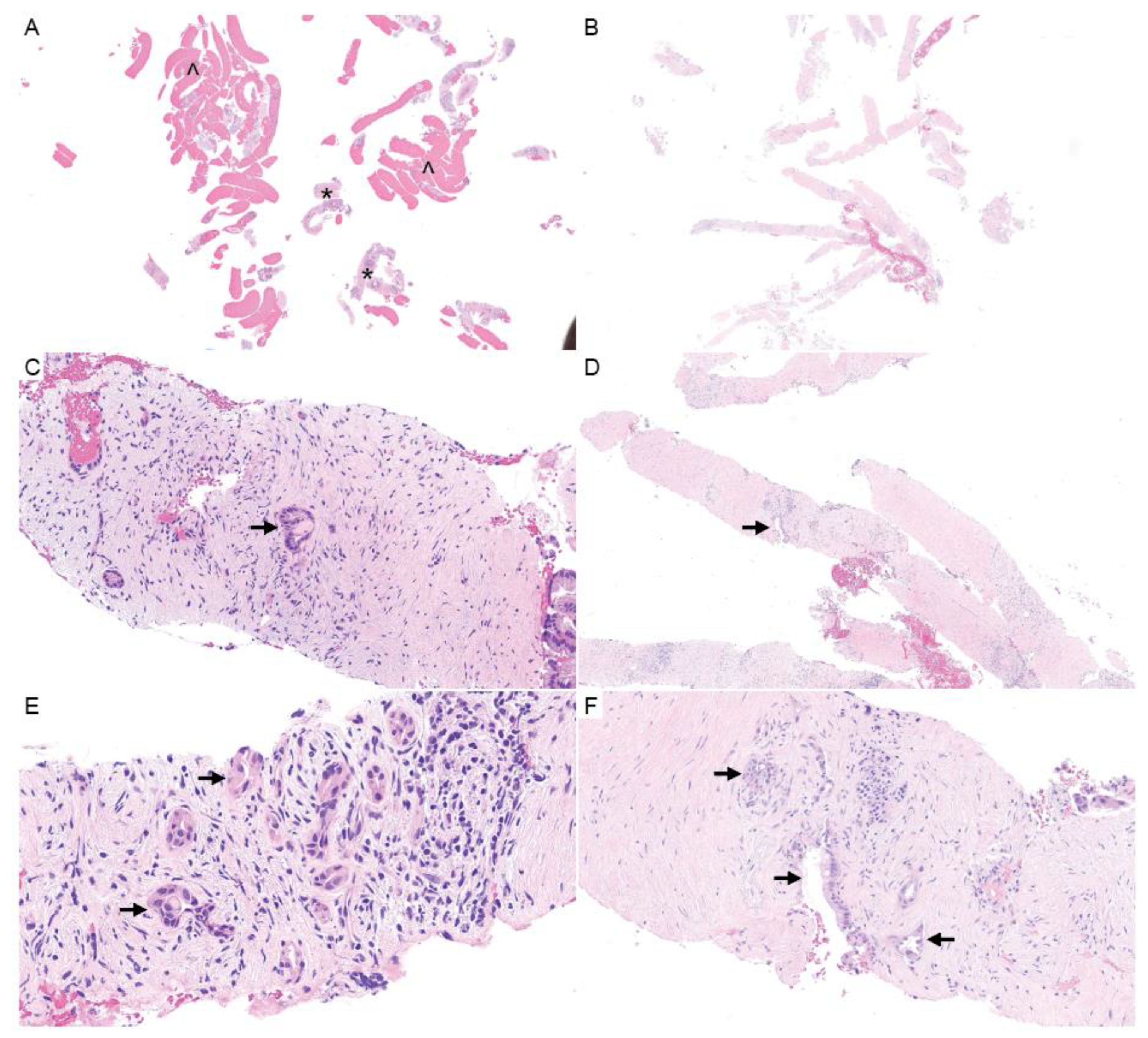 Cancers 16 00794 g003 Cancers 16 00794 g003