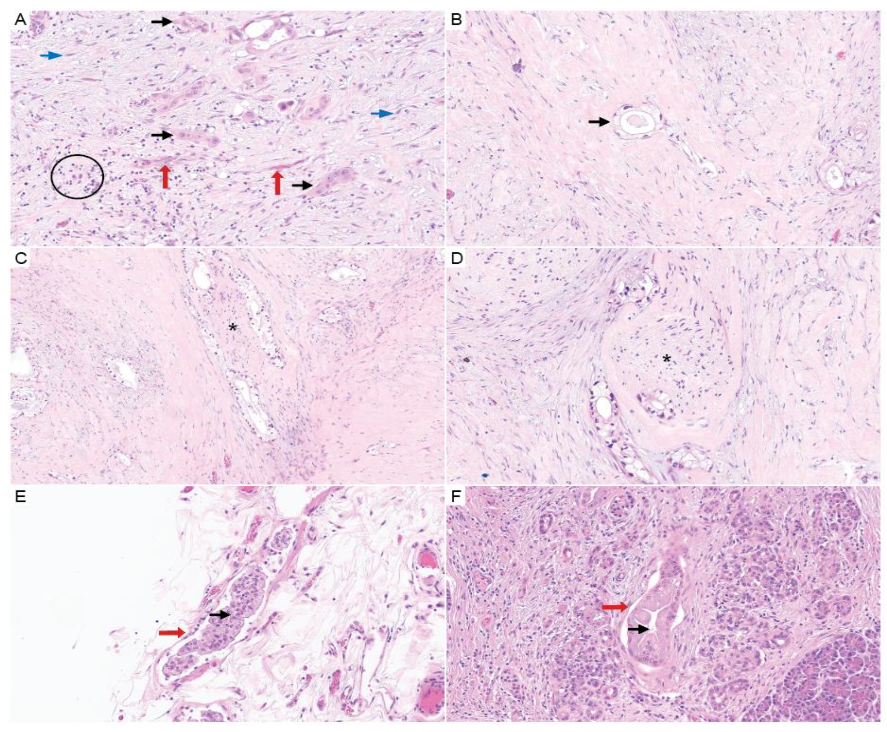 Cancers 16 00794 g004 Cancers 16 00794 g004