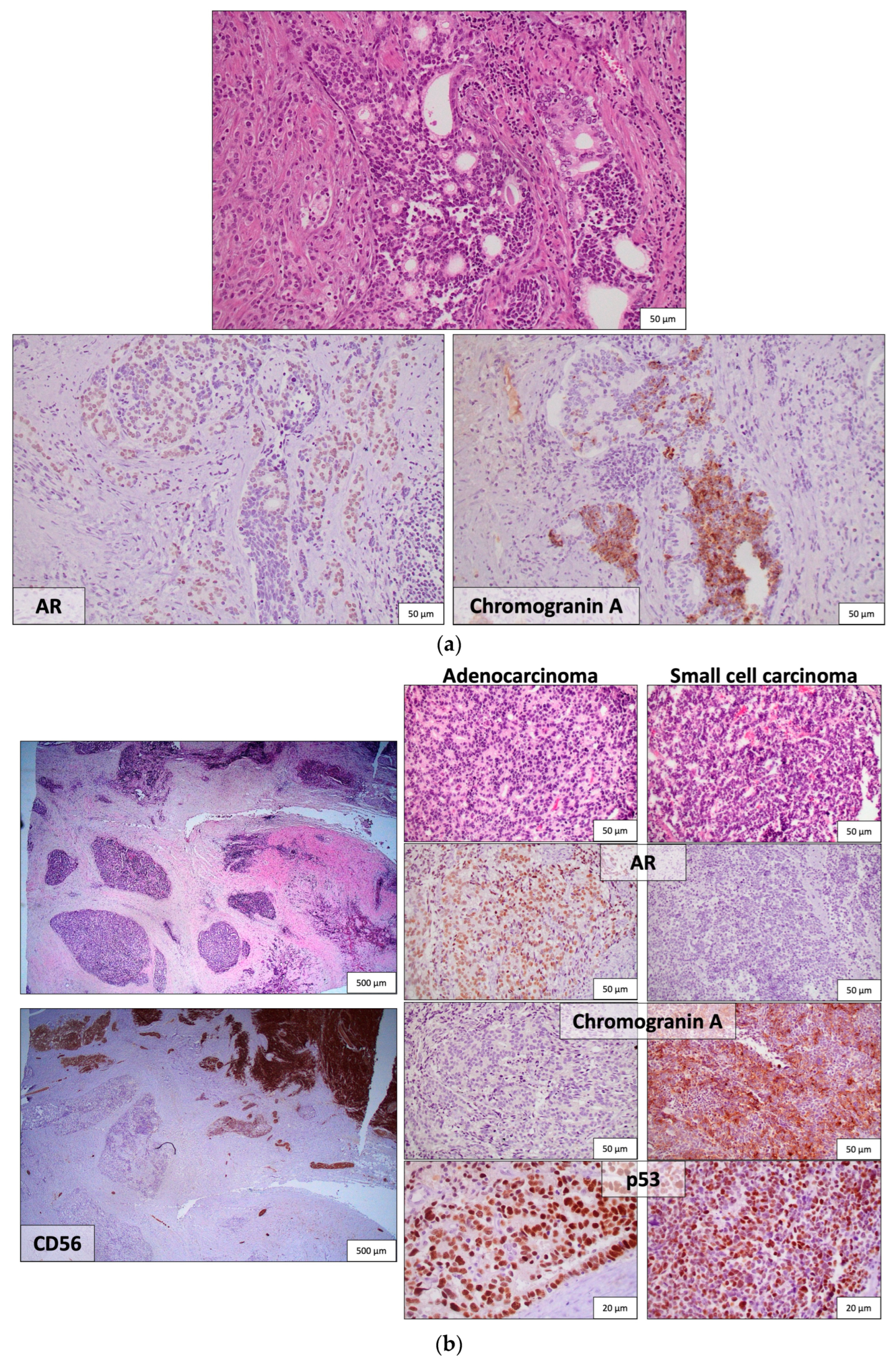 Cancers 16 00805 g001 Cancers 16 00805 g001