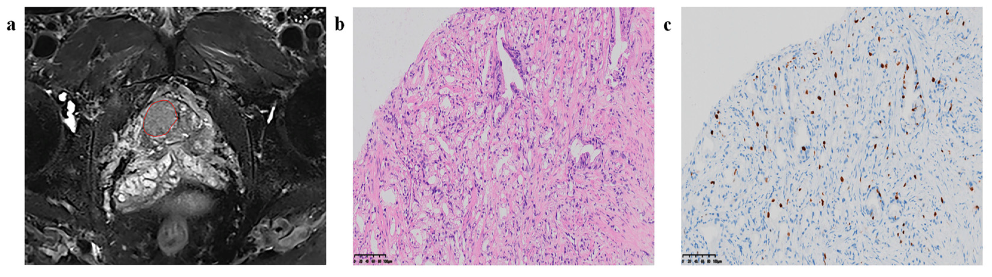 Cancers 16 00810 g004