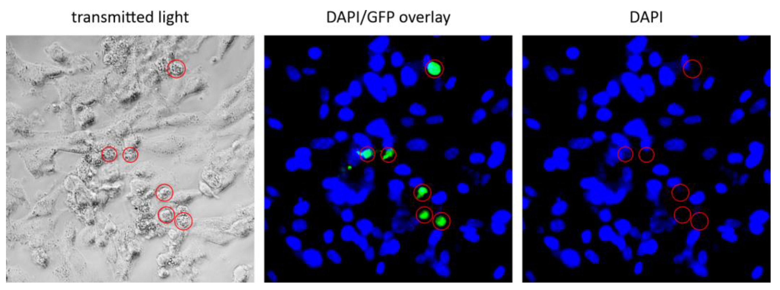 Cancers 16 00814 g007