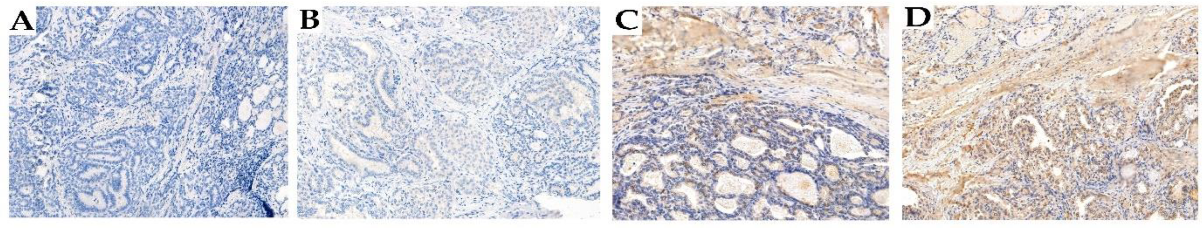 Cancers 16 00815 g002