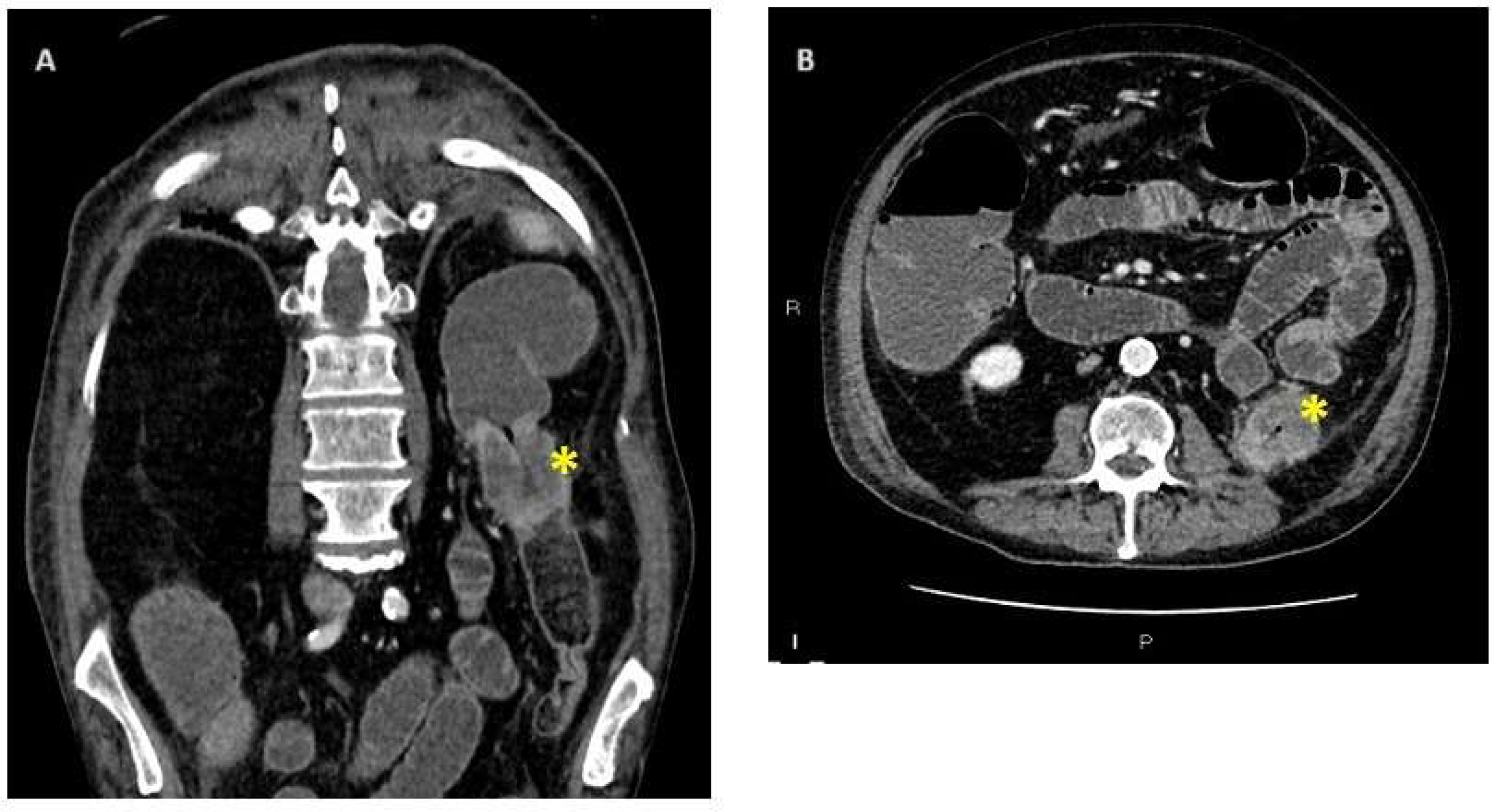 Cancers 16 00821 g001