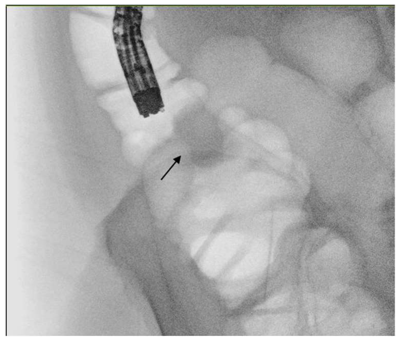 Cancers 16 00821 g003