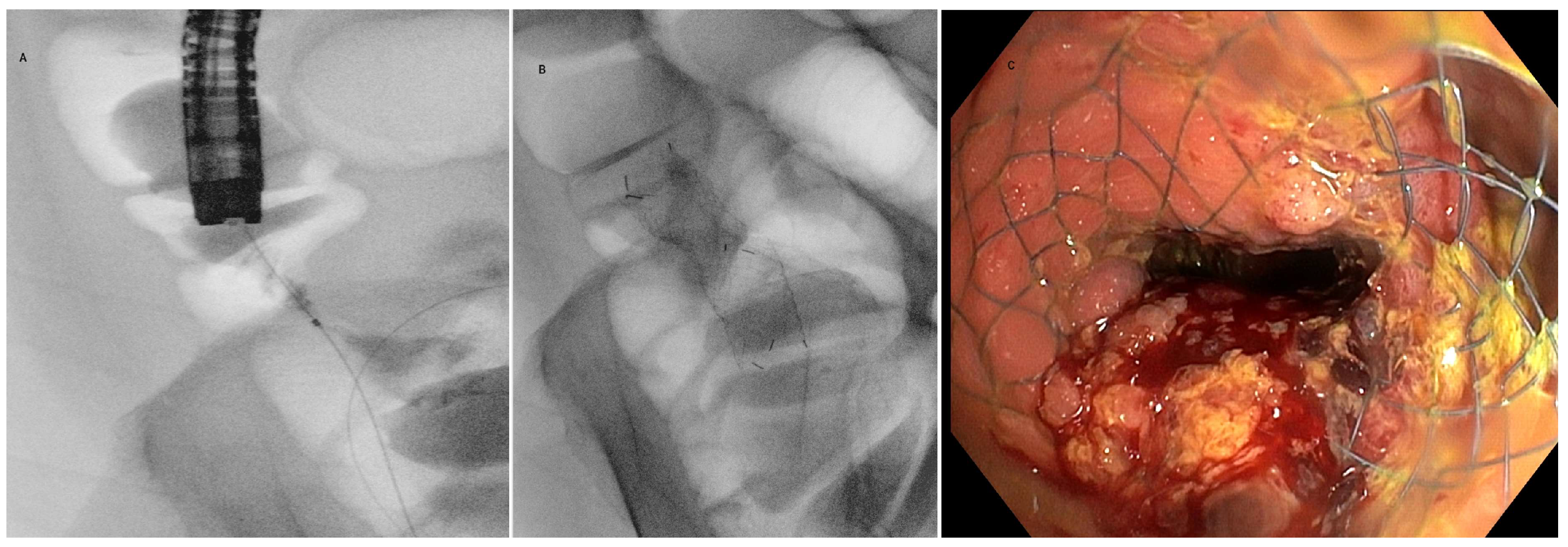 Cancers 16 00821 g004