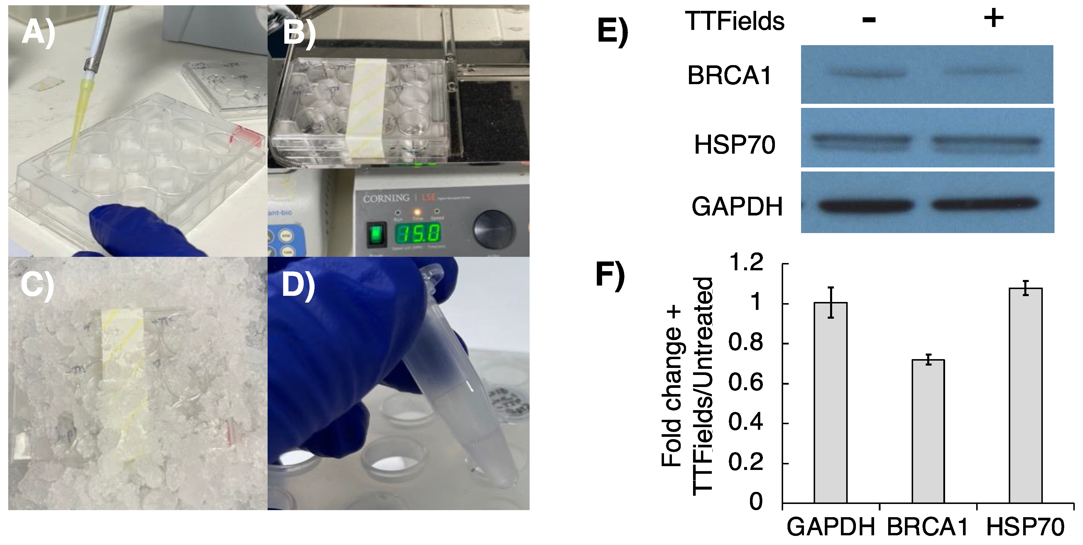Cancers 16 00863 g004