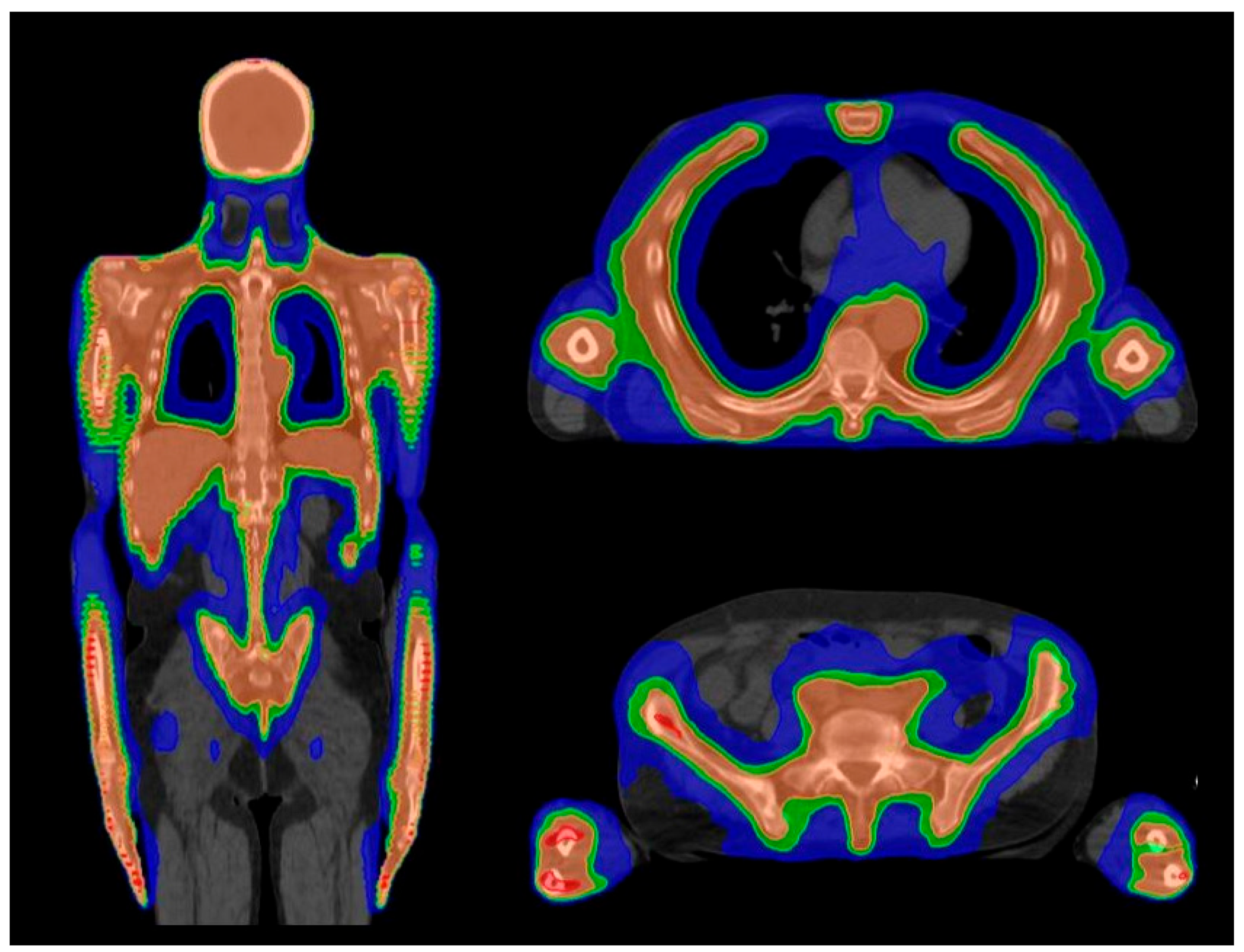 Cancers 16 00865 g001 Cancers 16 00865 g001