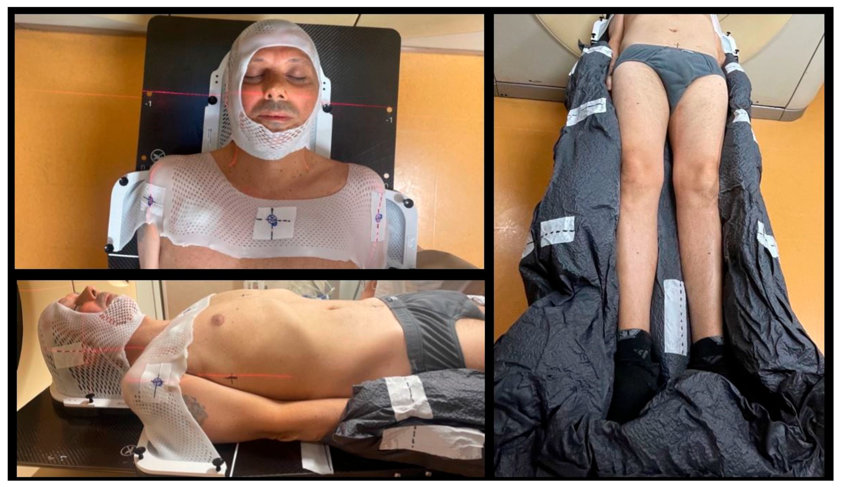 Cancers 16 00865 g002 Cancers 16 00865 g002