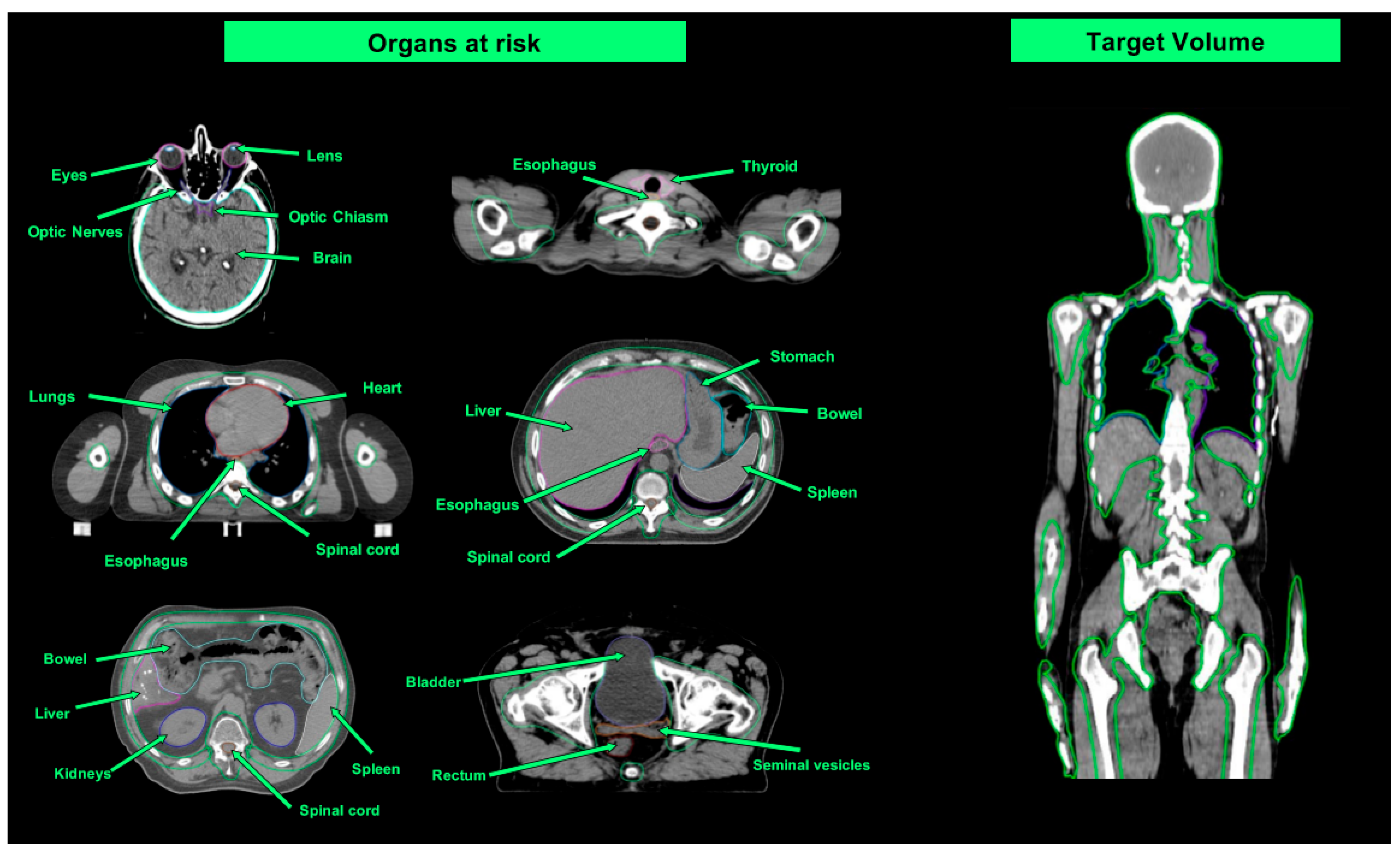 Cancers 16 00865 g003 Cancers 16 00865 g003