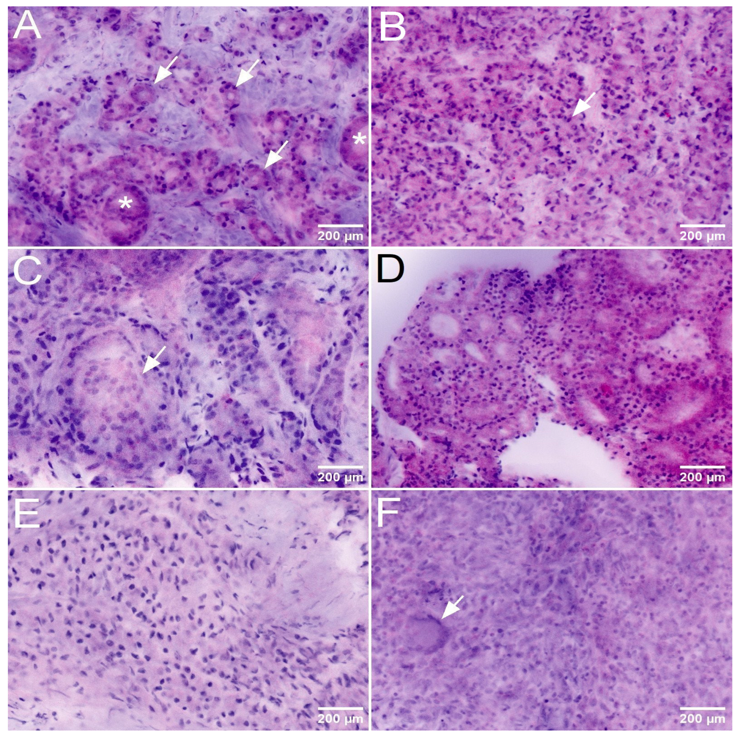 Cancers 16 00873 g002