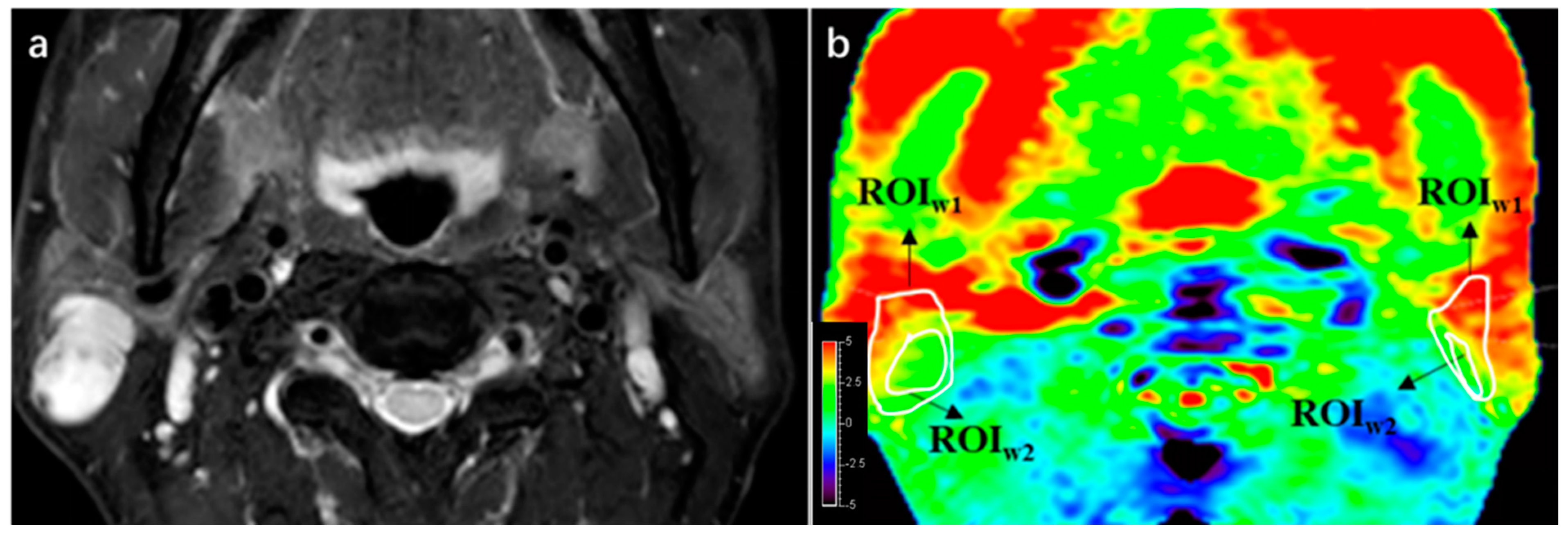 Cancers 16 00888 g002