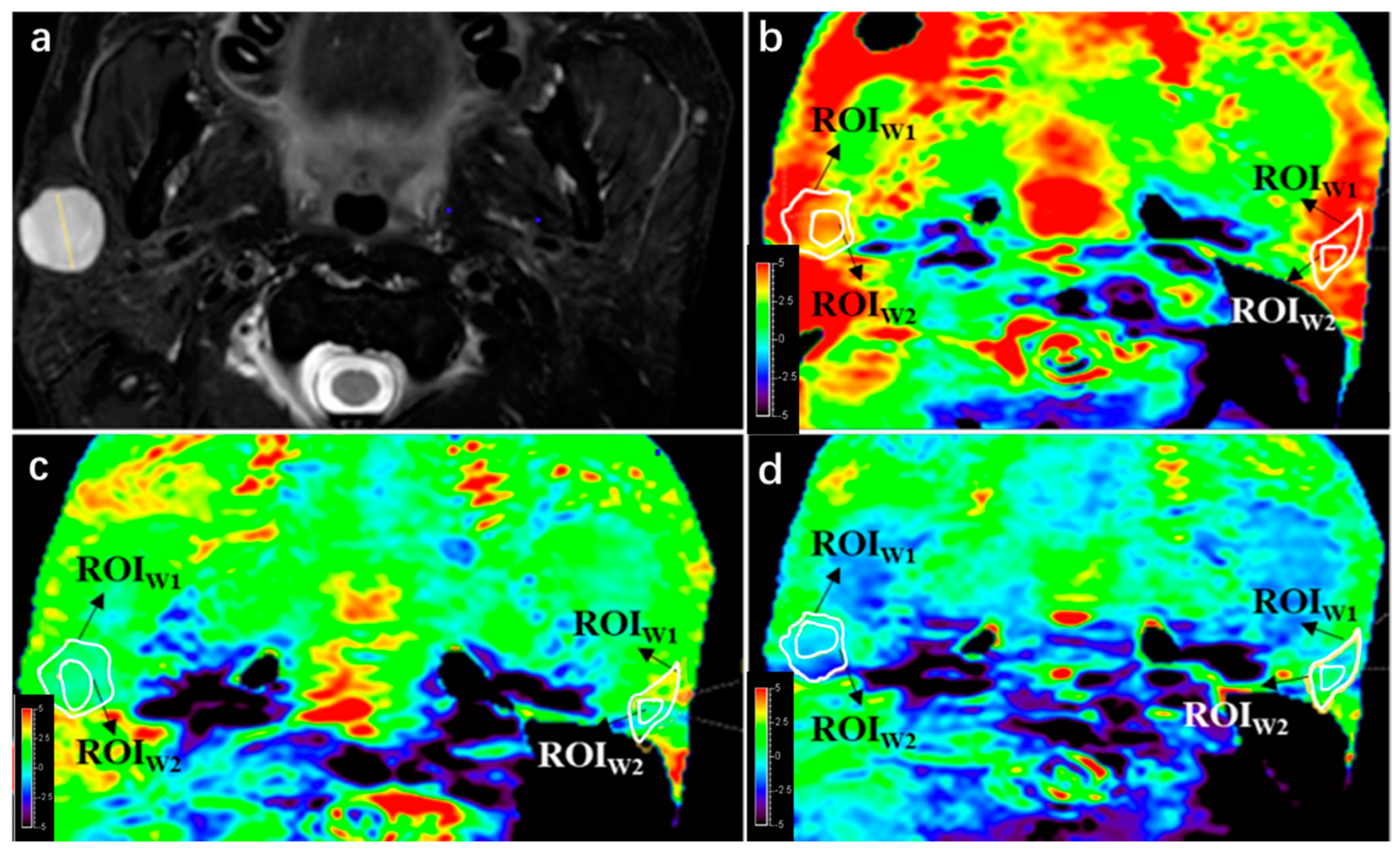 B1 Power Modification for Amide Proton Transfer Imaging in