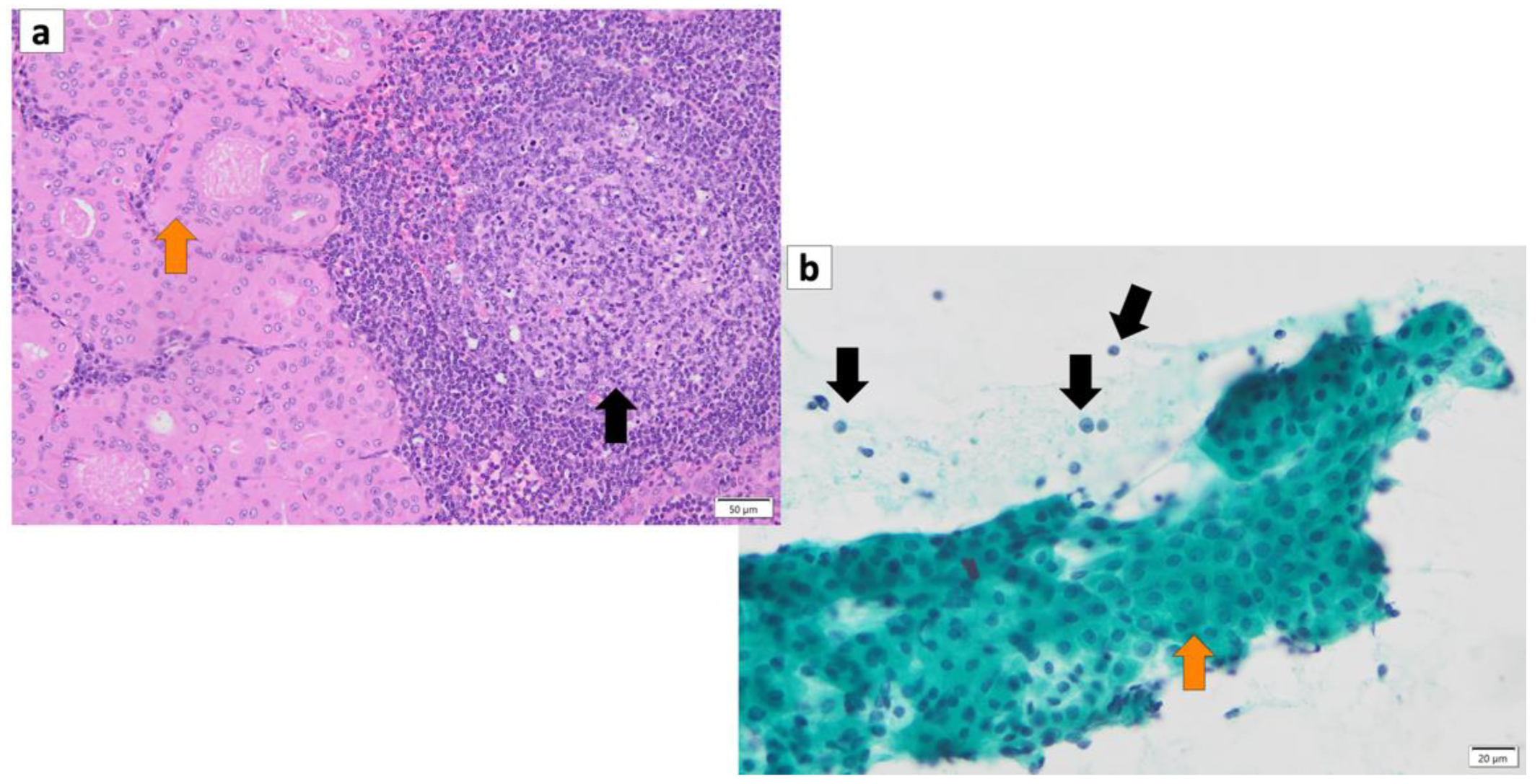 Cancers 16 00912 g002