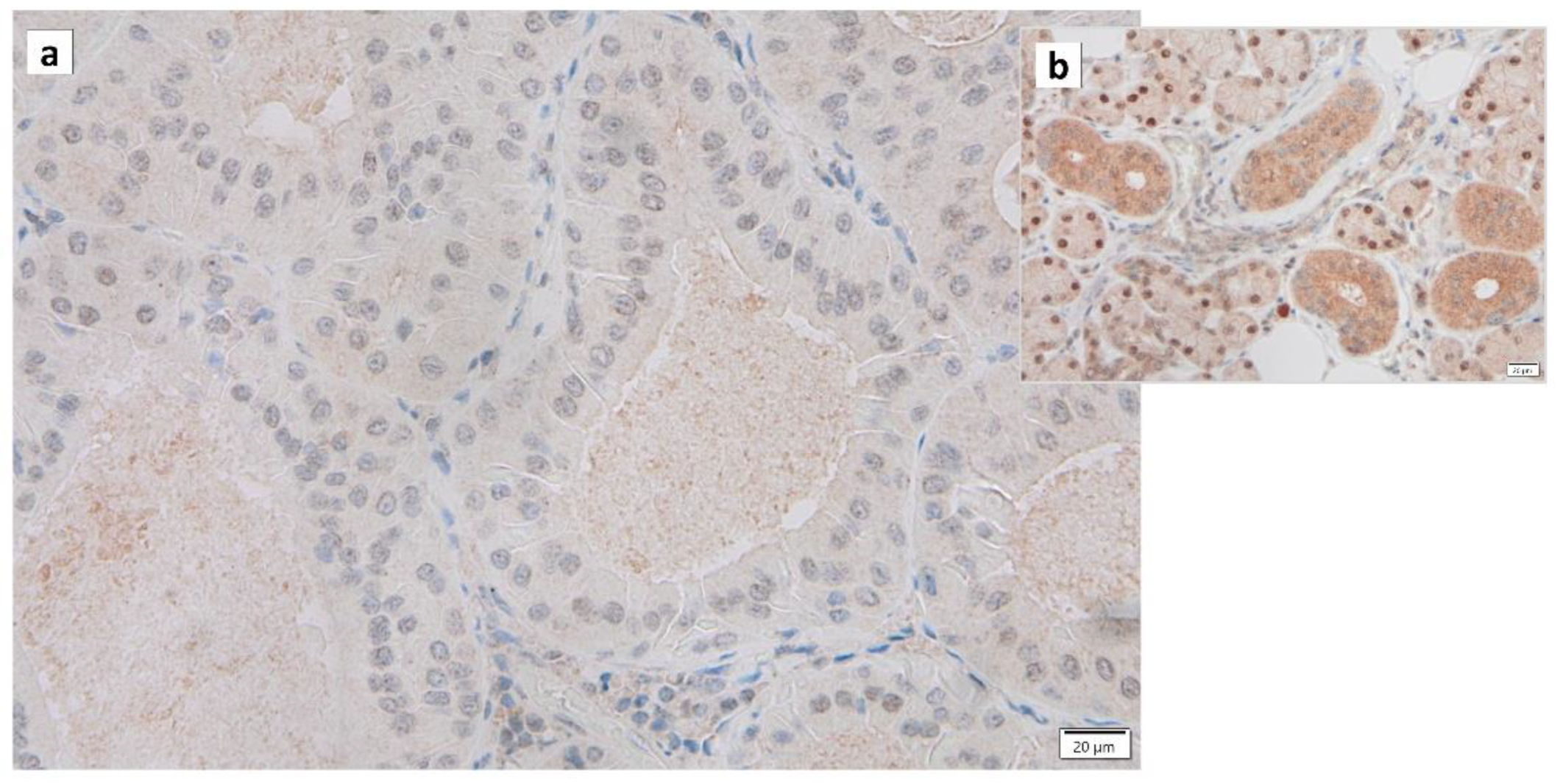 Cancers 16 00912 g003