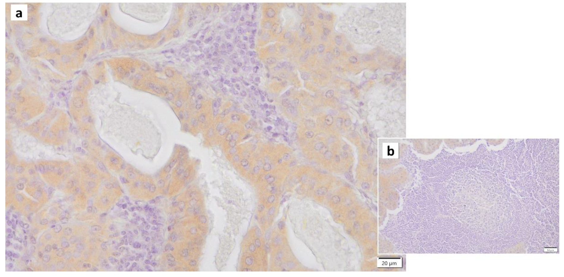 Cancers 16 00912 g006