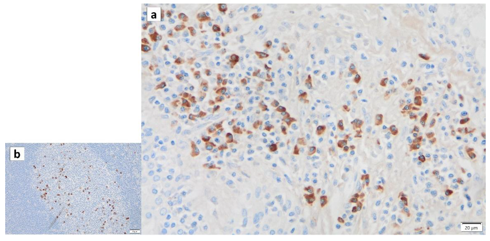 Cancers 16 00912 g008