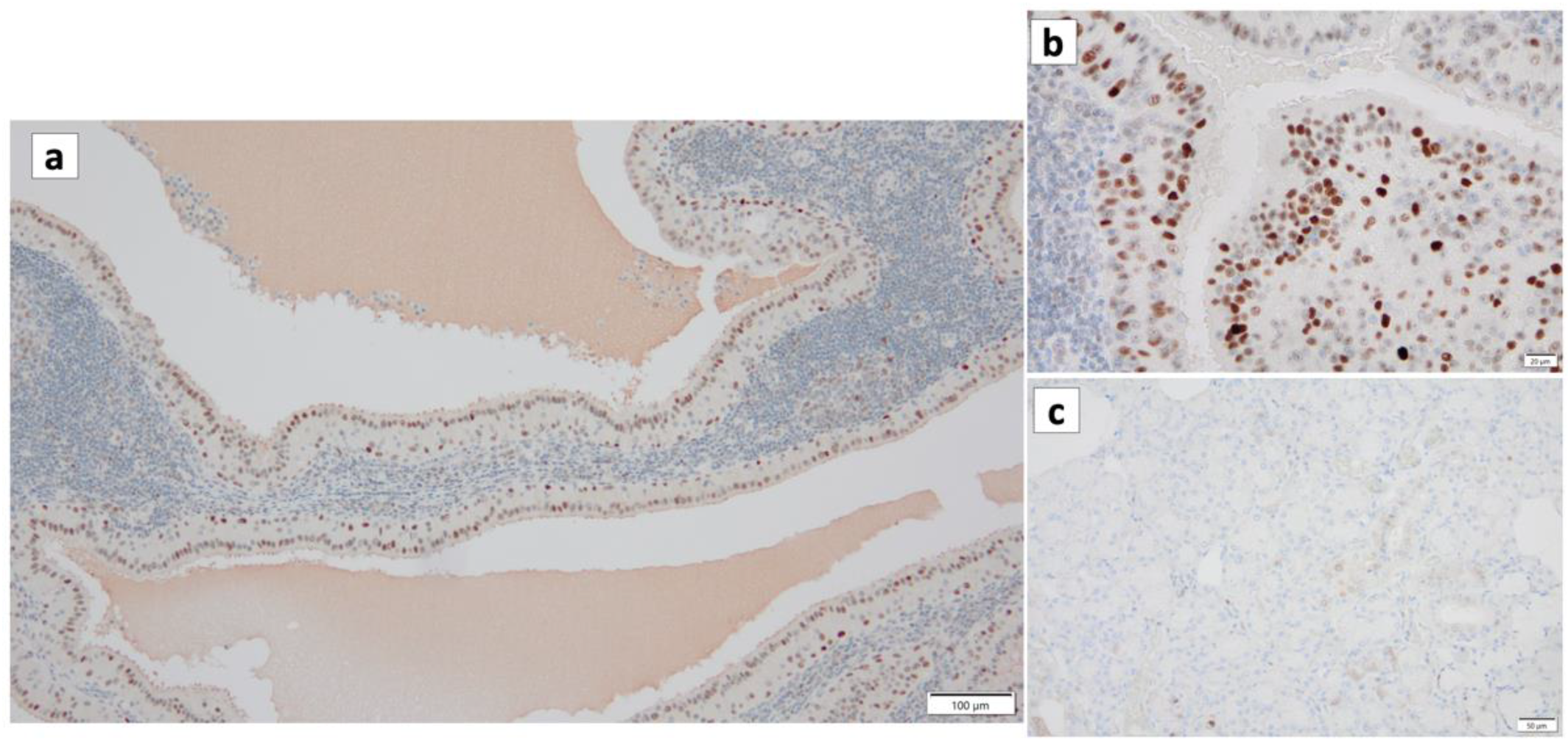 Cancers 16 00912 g011