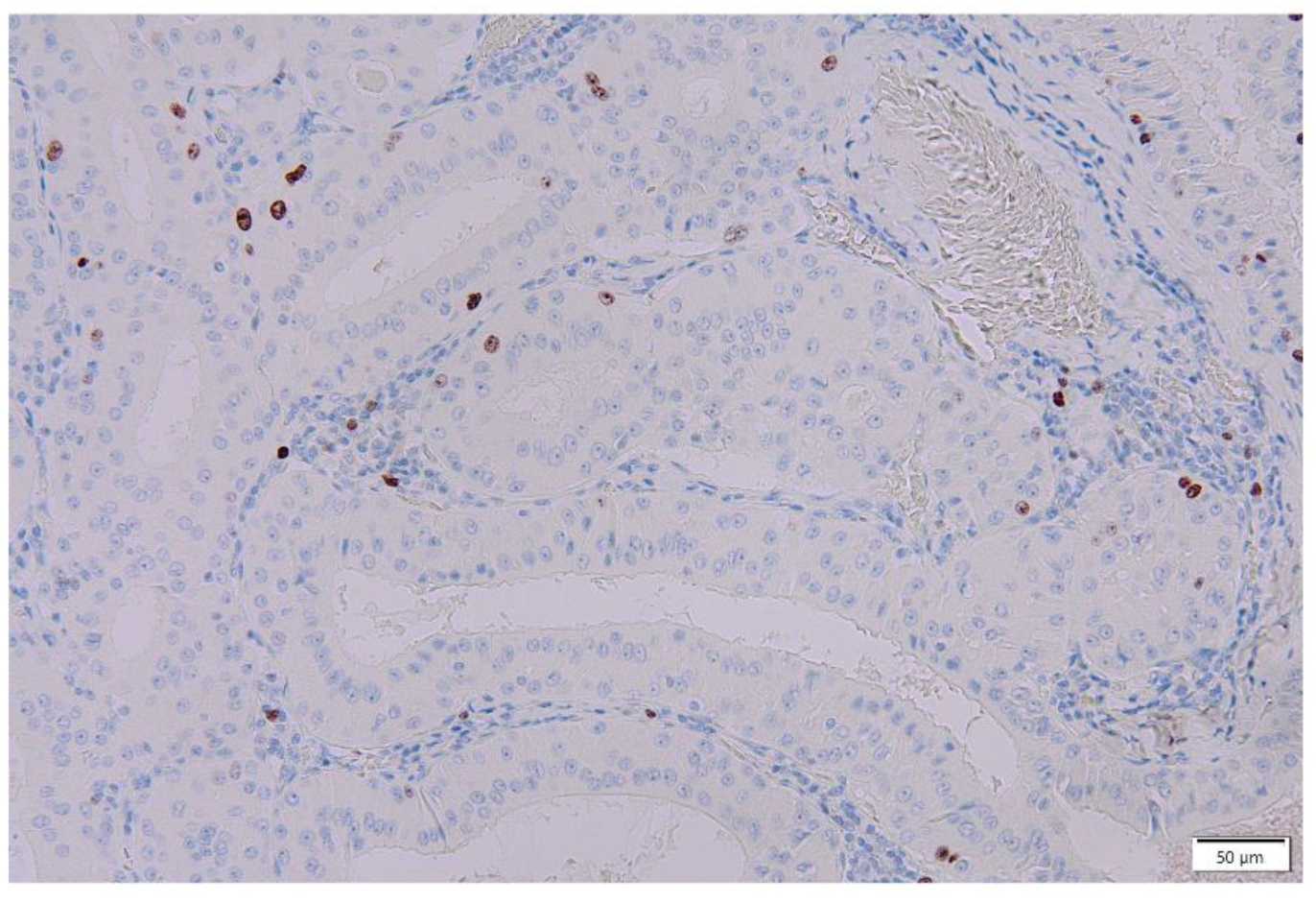 Cancers 16 00912 g012