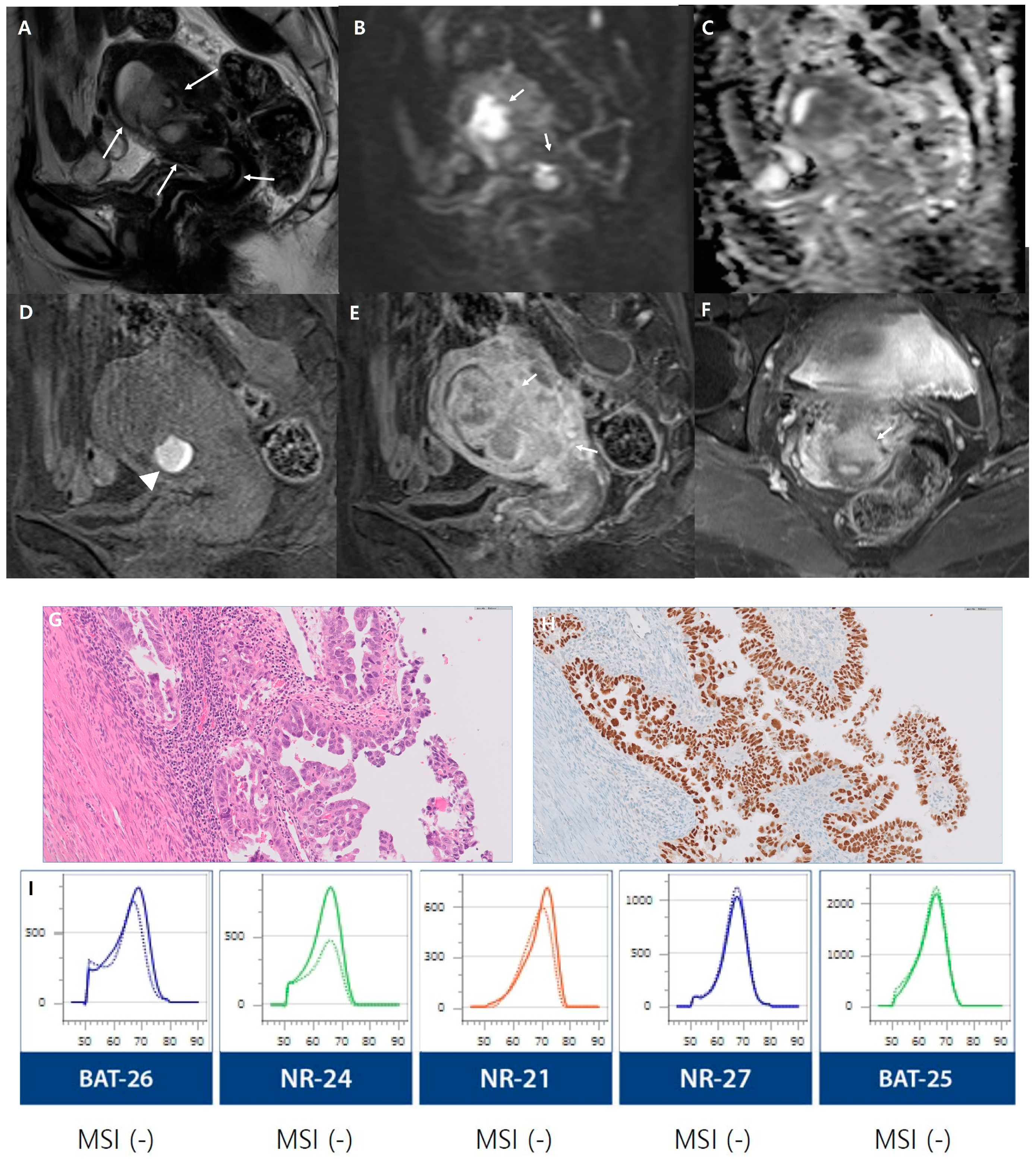 Cancers 16 00921 g002