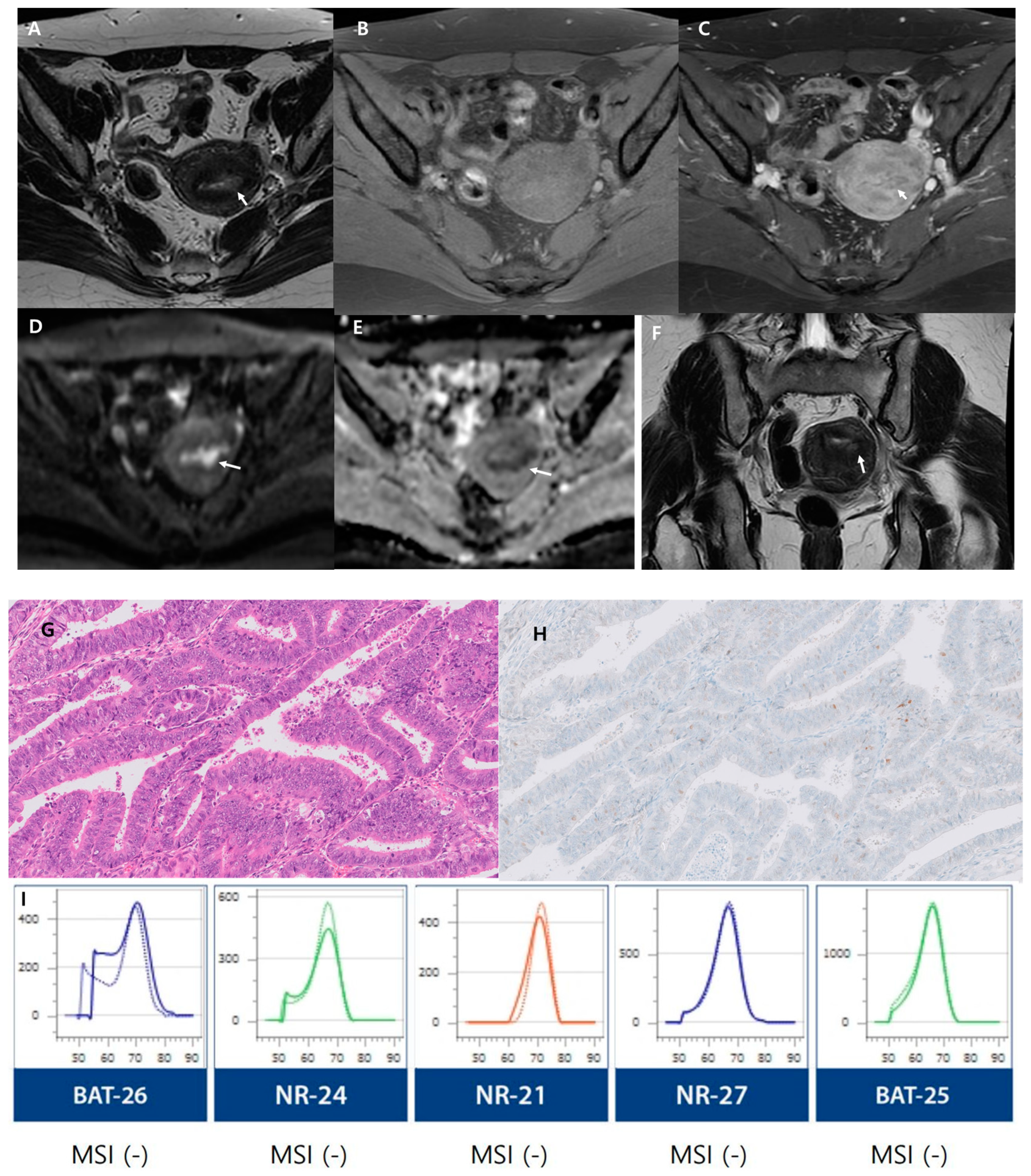Cancers 16 00921 g003