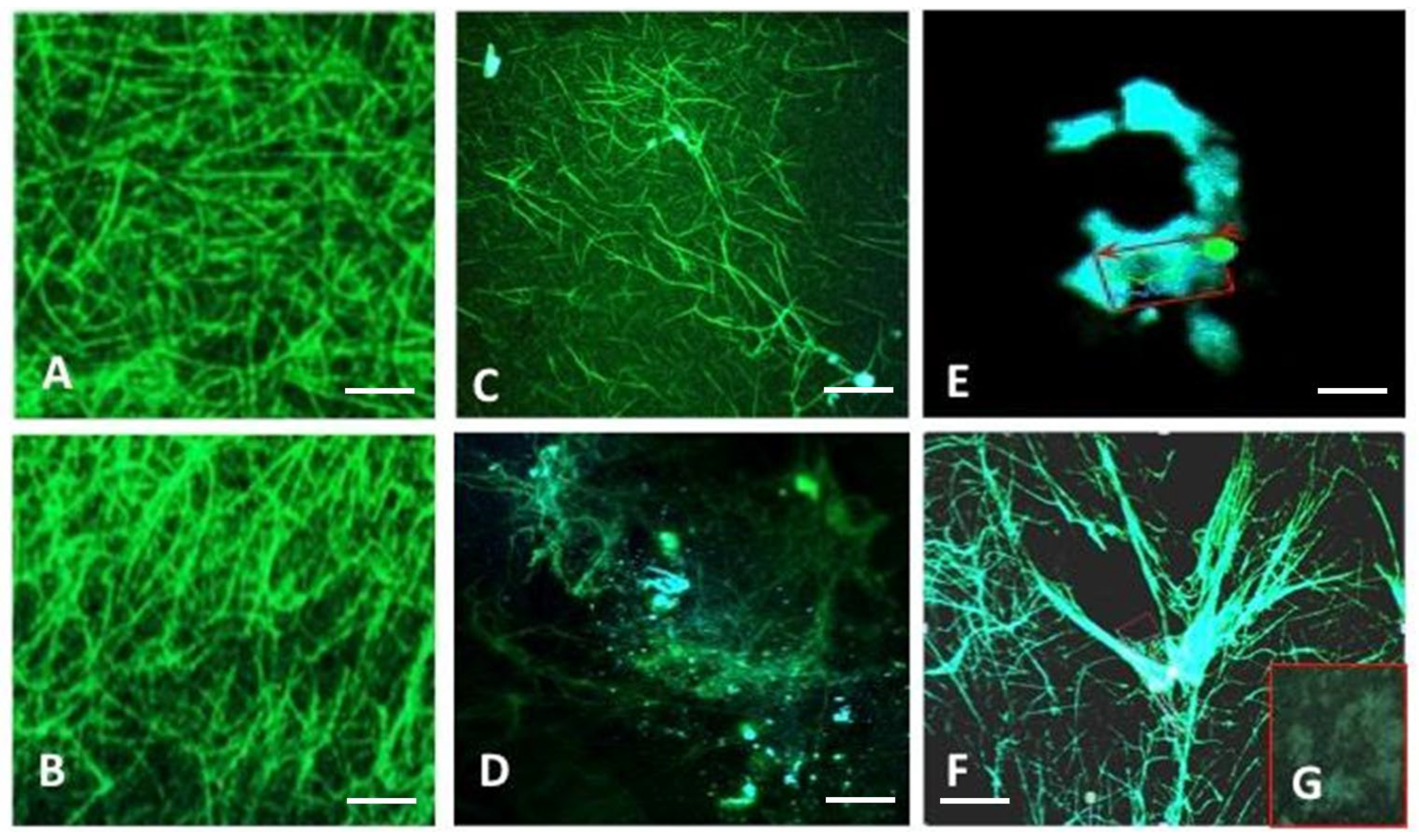 Cancers 16 00928 g005