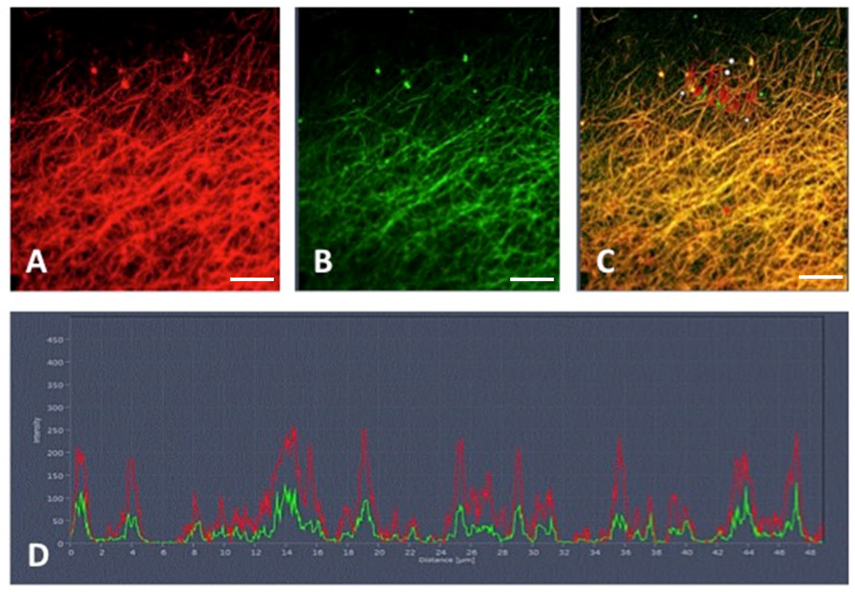Cancers 16 00928 g006