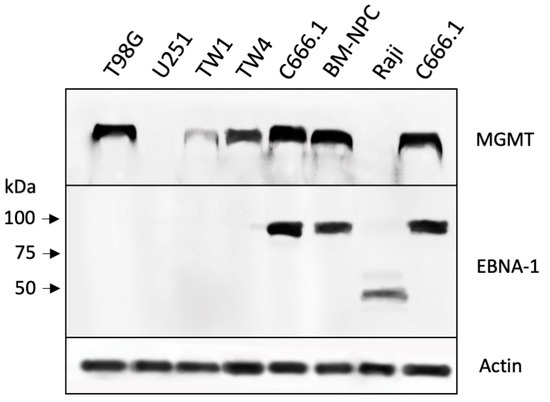 Activation of Epstein–Barr Virus' Lytic Cycle in Activation of Epstein–Barr Virus' Lytic Cycle in