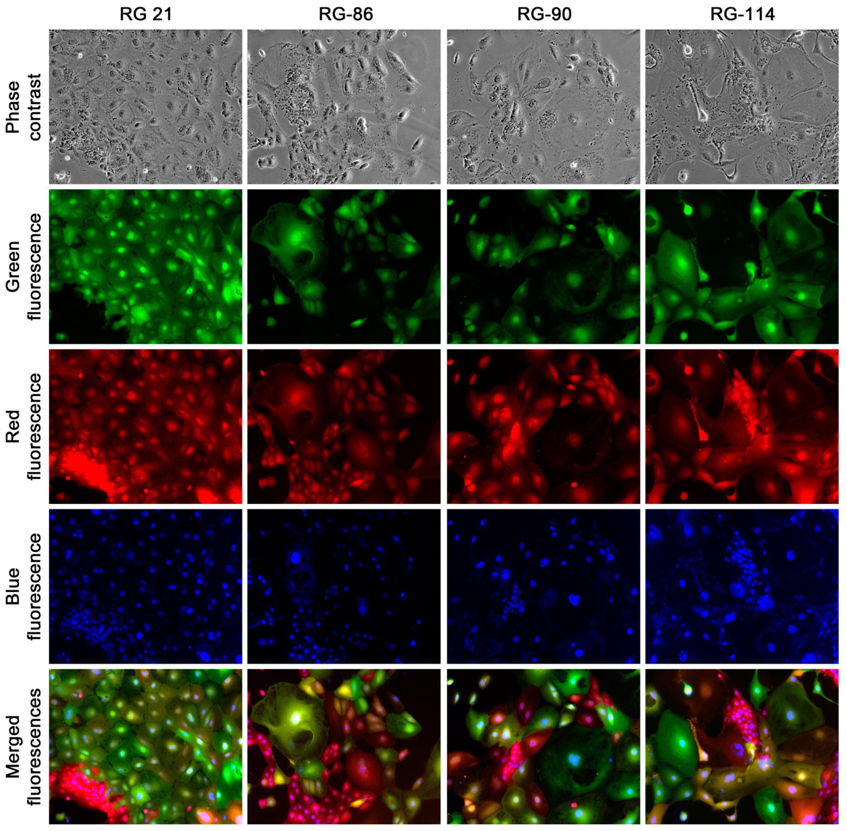 Cancers 16 00951 g007