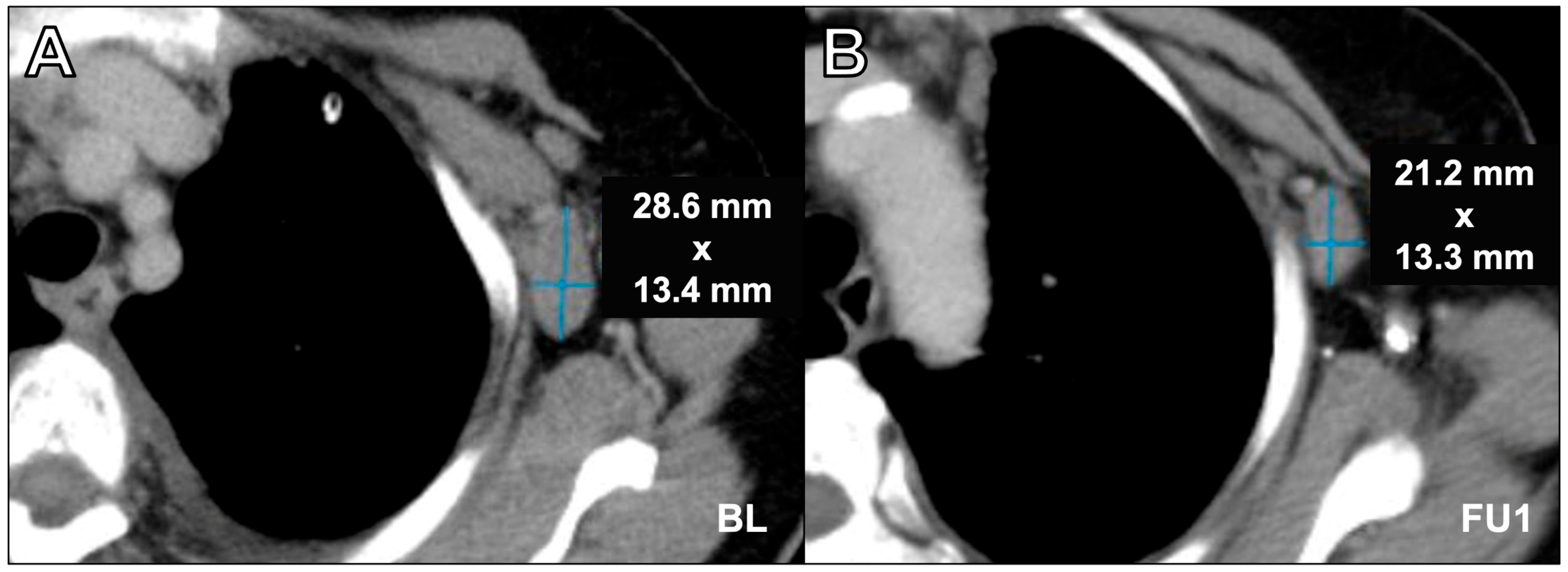 Cancers 16 00993 g004 Cancers 16 00993 g004