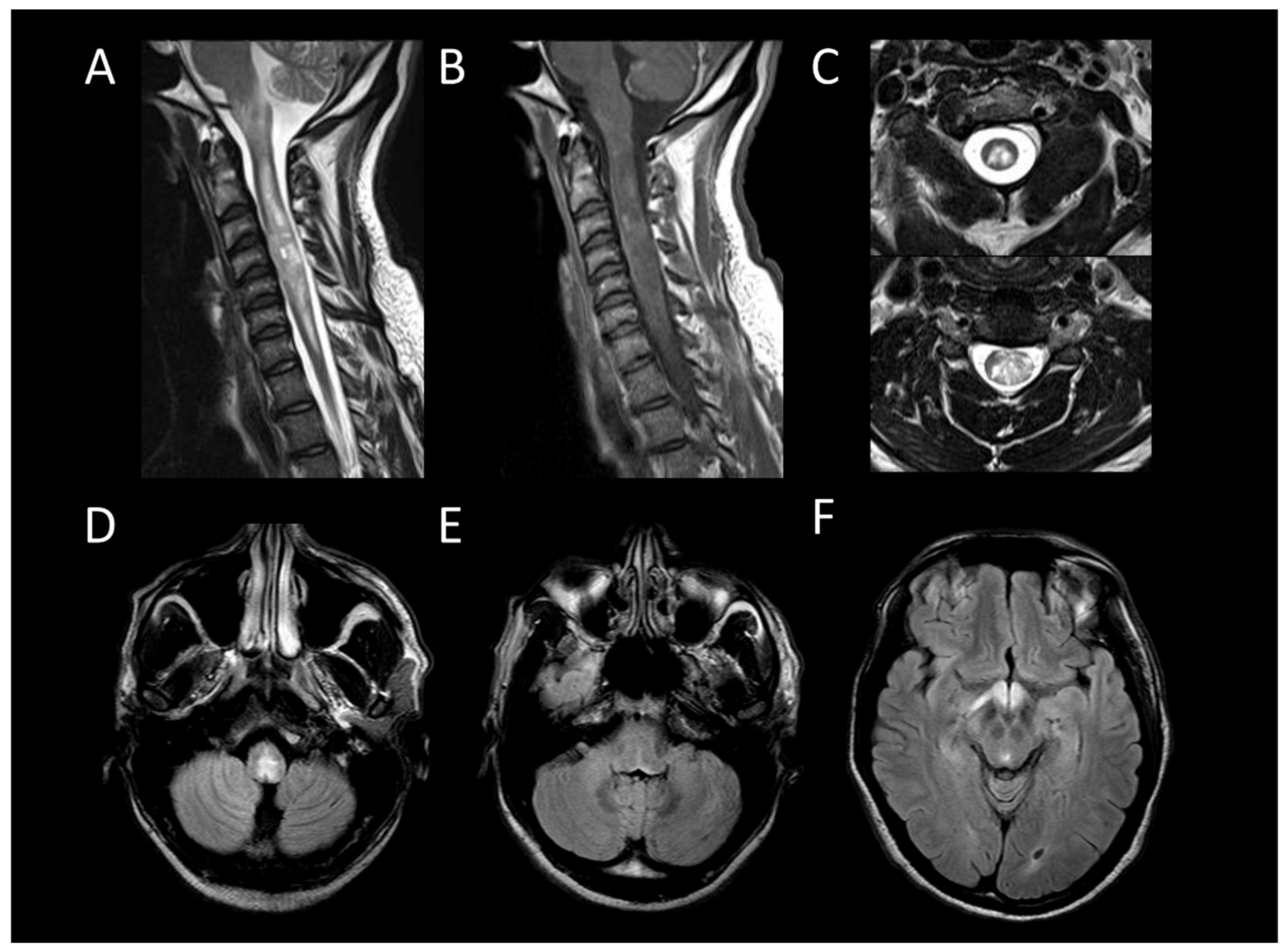 Cancers 16 01004 g002